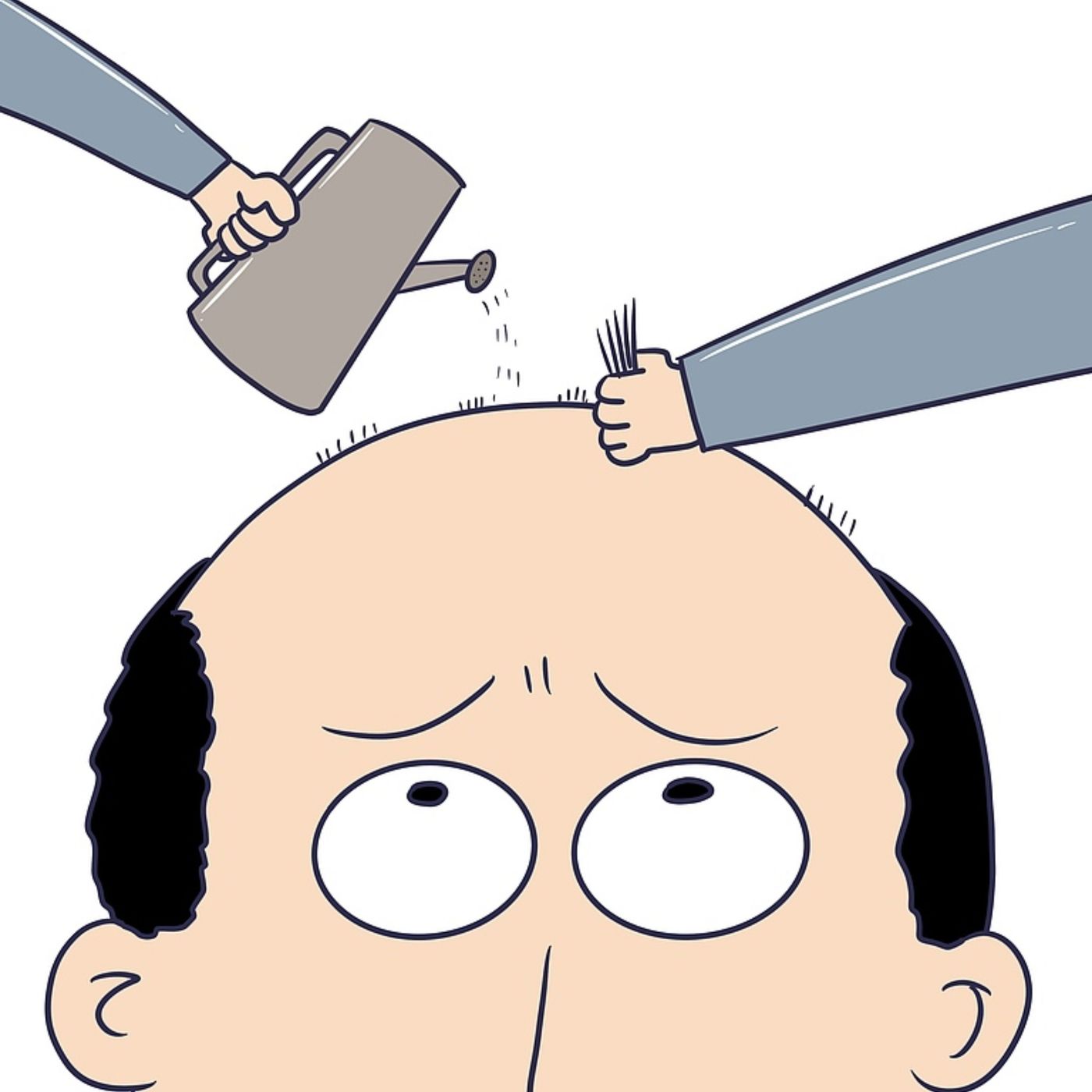 Considering a hair transplant? Things to know.