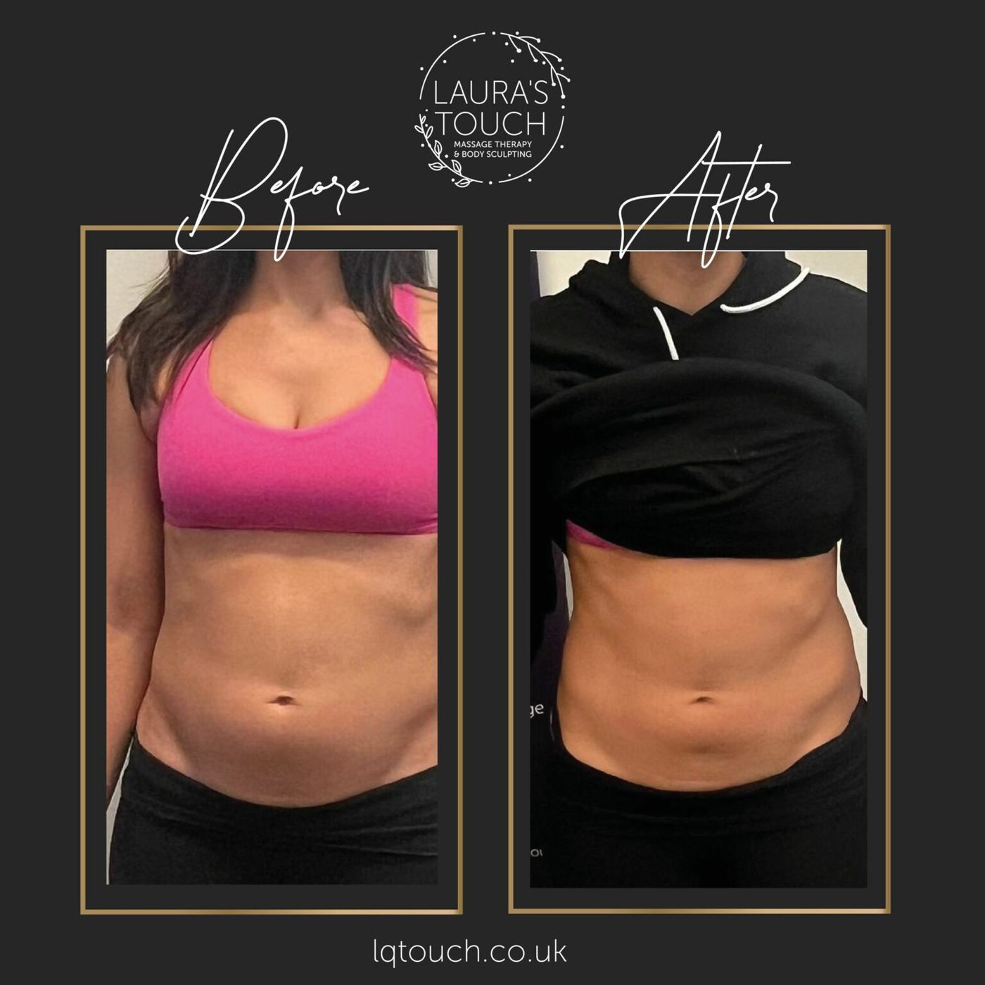 Body Contouring Trends What’s Popular Right Now episode artwork