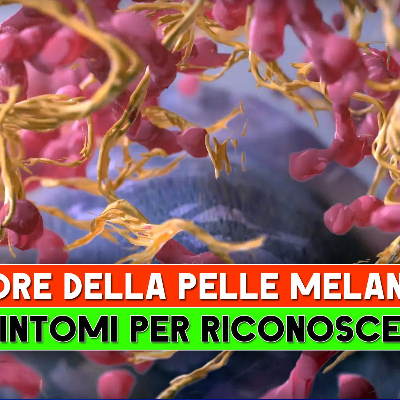 Tumore Della Pelle, Melanoma: I 5 Sintomi Per Riconoscerlo! episode artwork