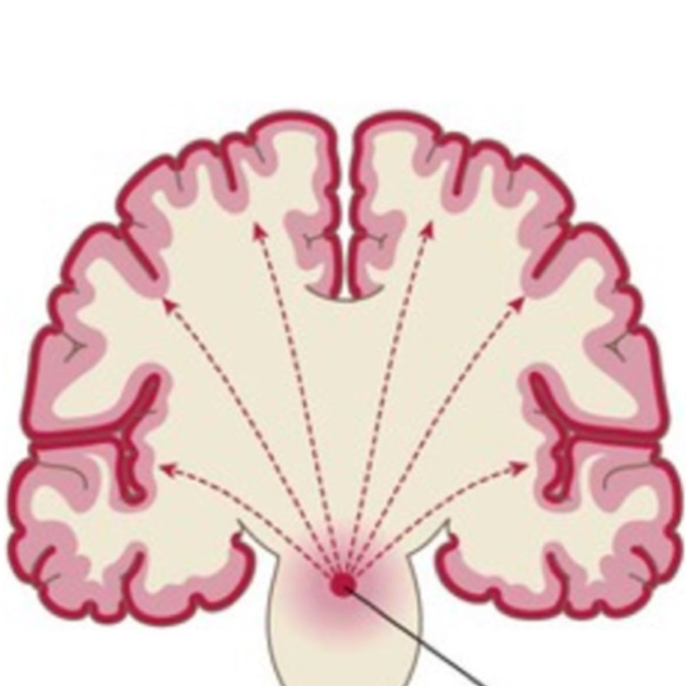 The Epilepsy Spectrum