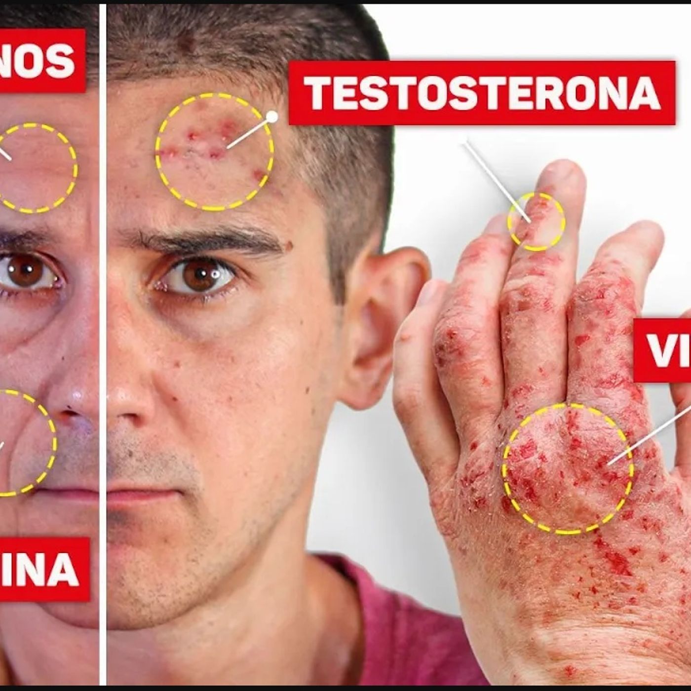 ¡TRANSFORMA tu PIEL entendiendo TUS HORMONAS!
