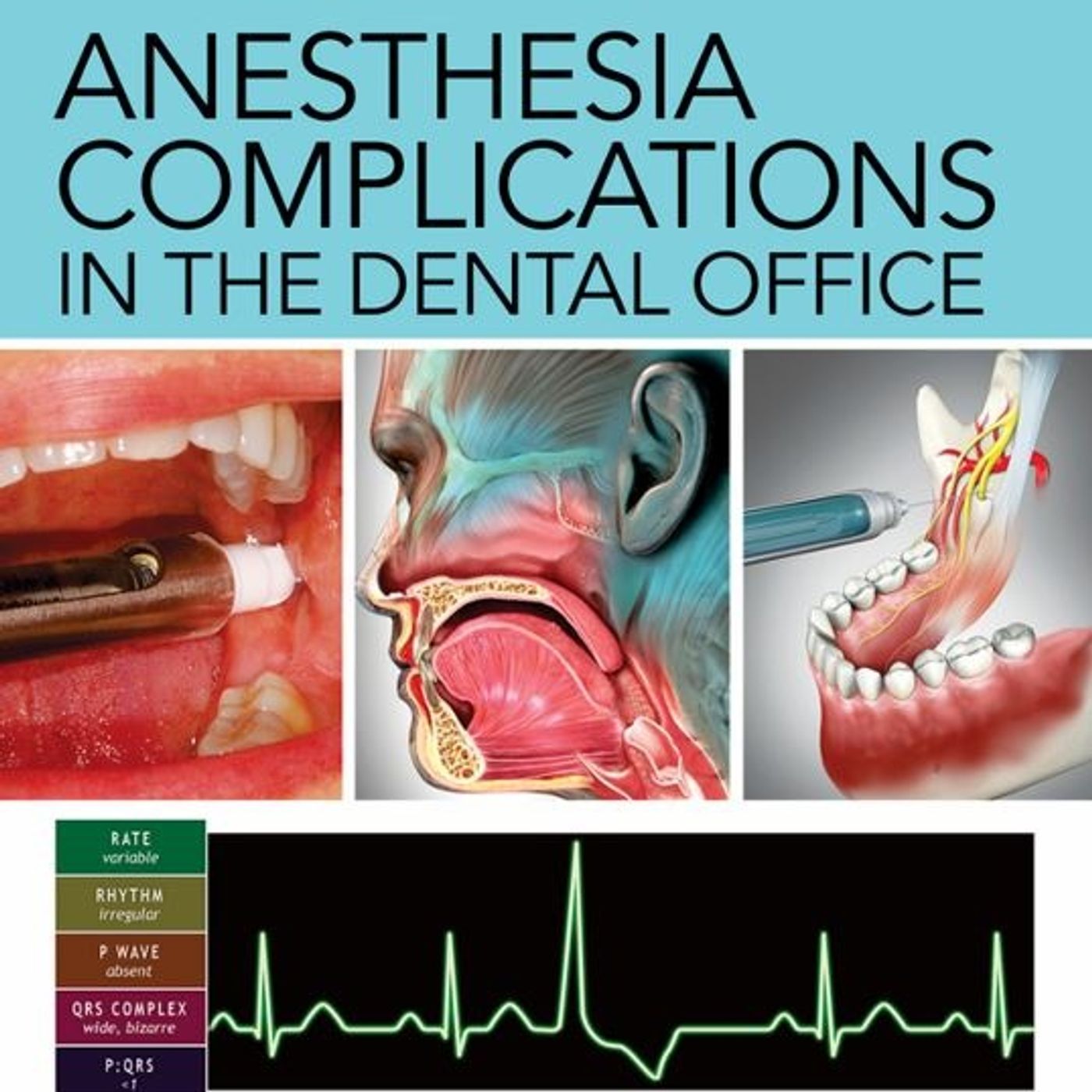 Anesthesia complications in the dental office