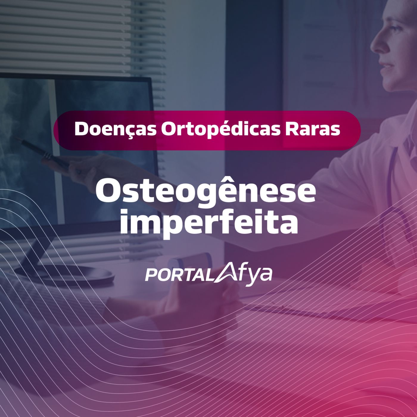 Podcast #151: Série Doenças Raras Ortopédicas: Osteogênese Imperfeita episode artwork