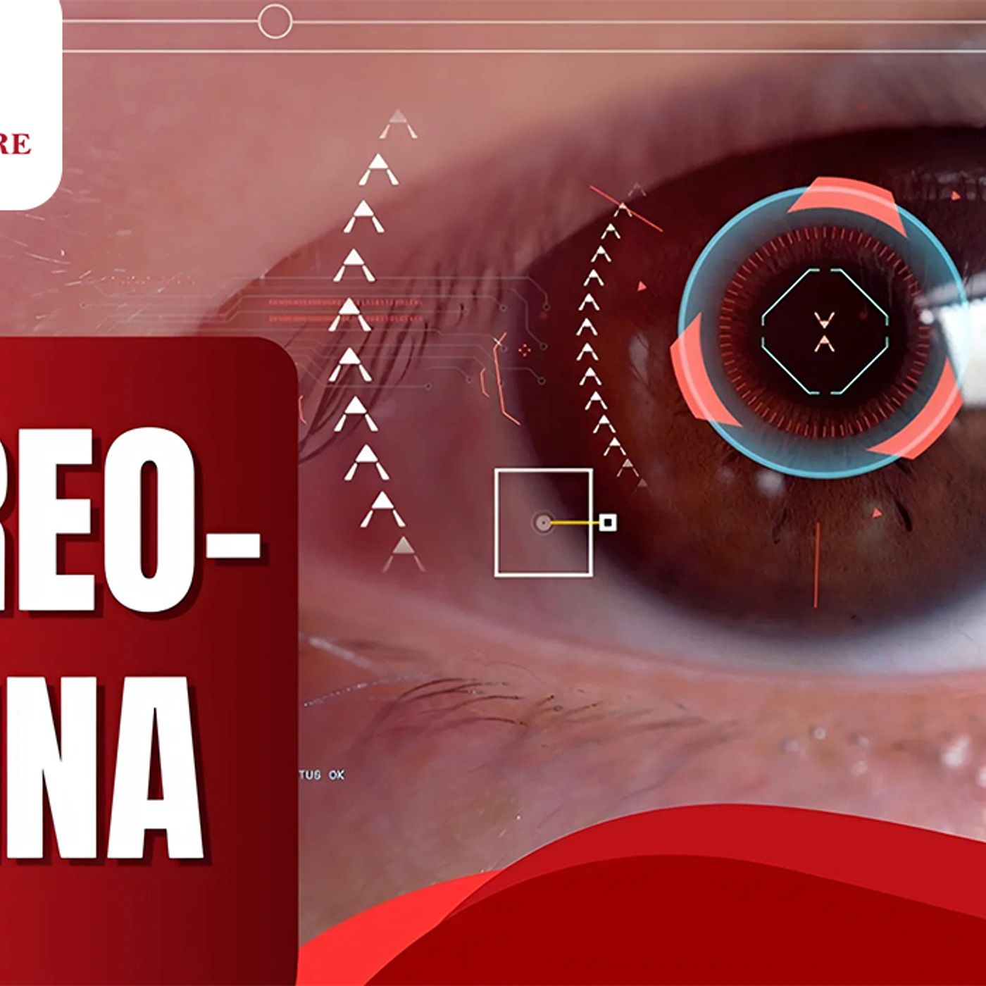 Can Refractive Errors Be Prevented?