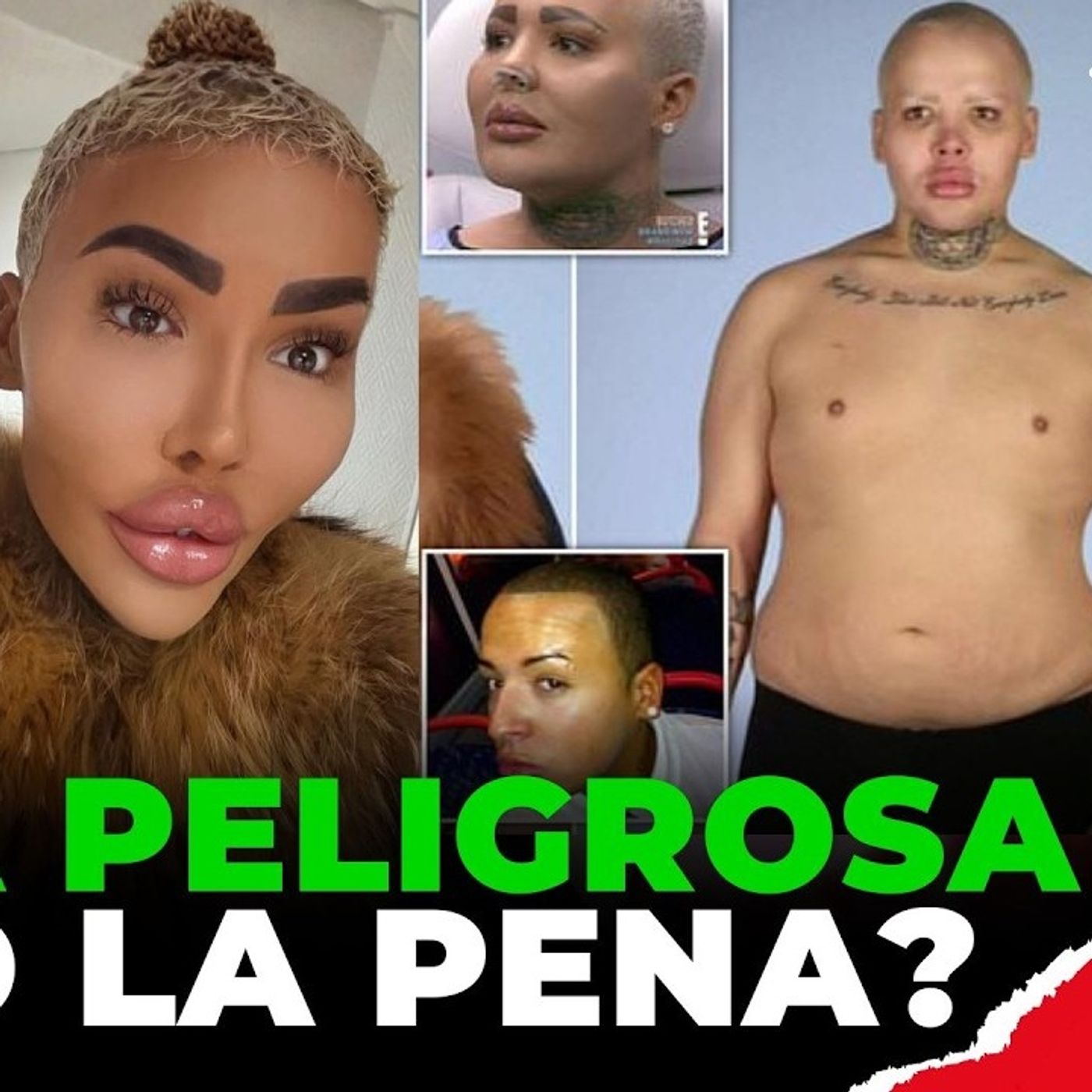 LAMENTABLE FINAL DE EL REY DE LOS LABIOS ¦ 150 MIL DÓLARES EN CAMBIOS FÍSICOS episode artwork