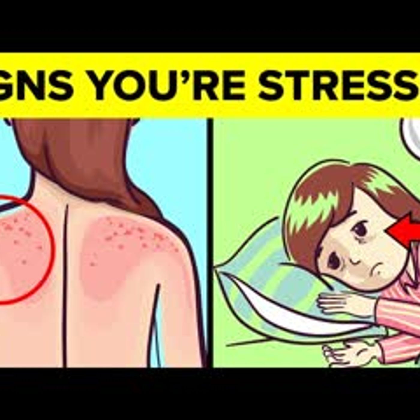 11 Silent STRESS Signs That Are Killing You Slowly episode artwork