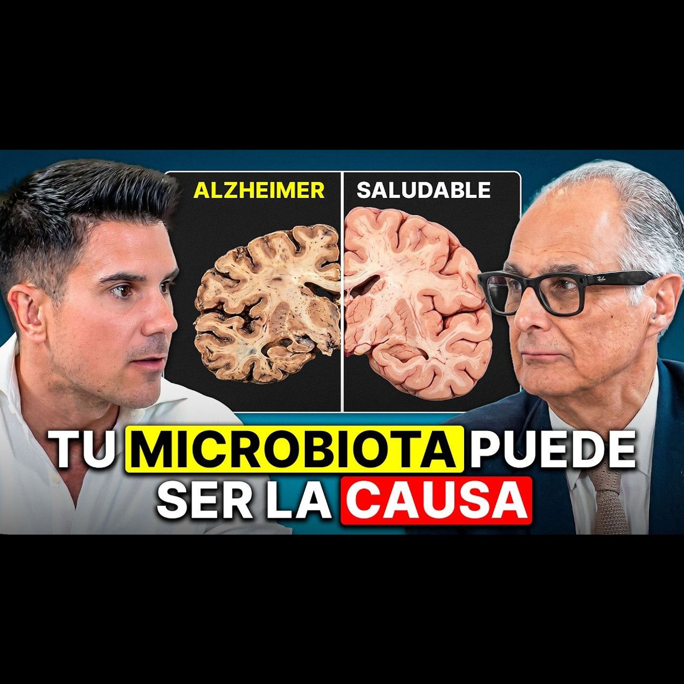 Catedrático de Fisiología: ¡La Demencia Empieza en tu Plato!