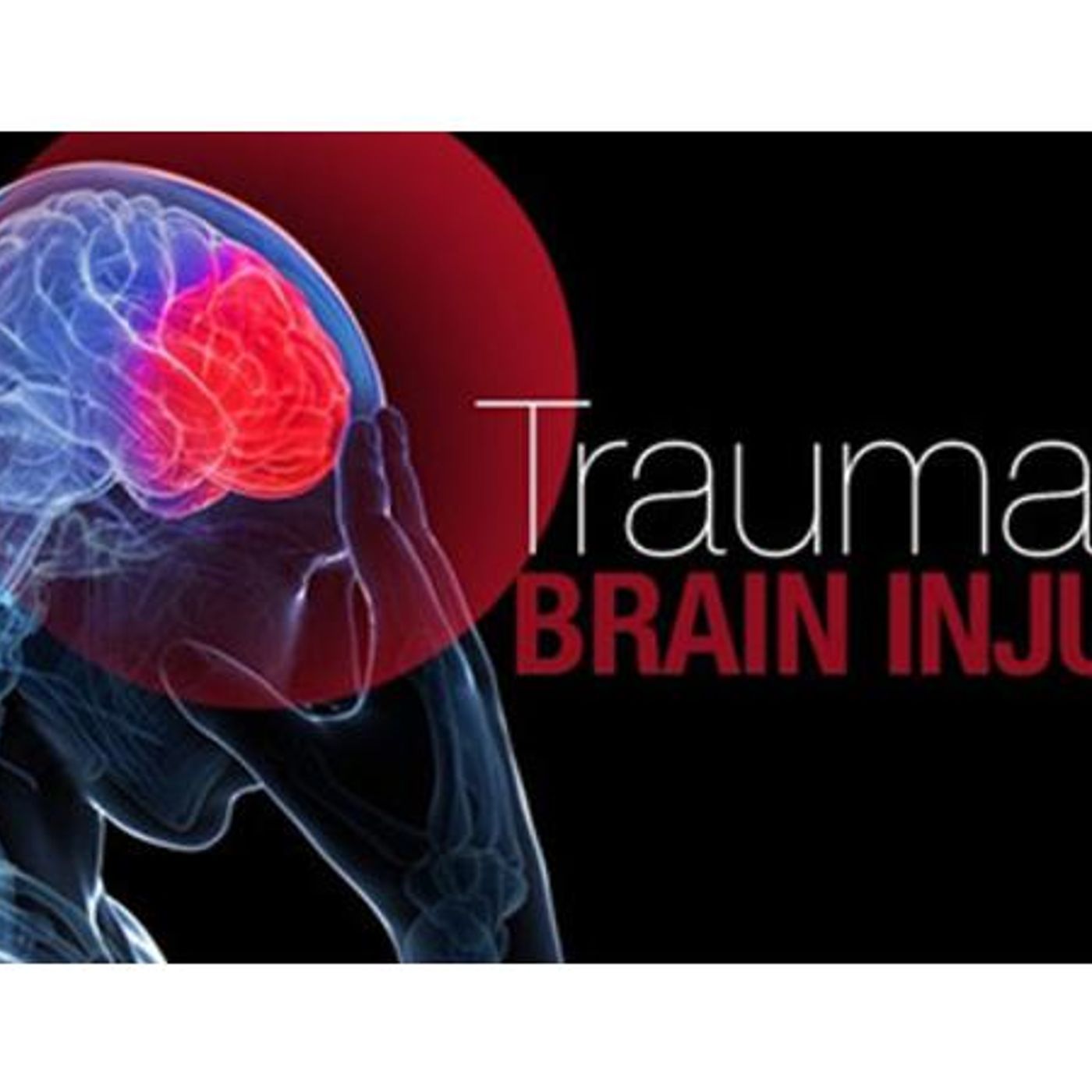 Surviving Head Trauma