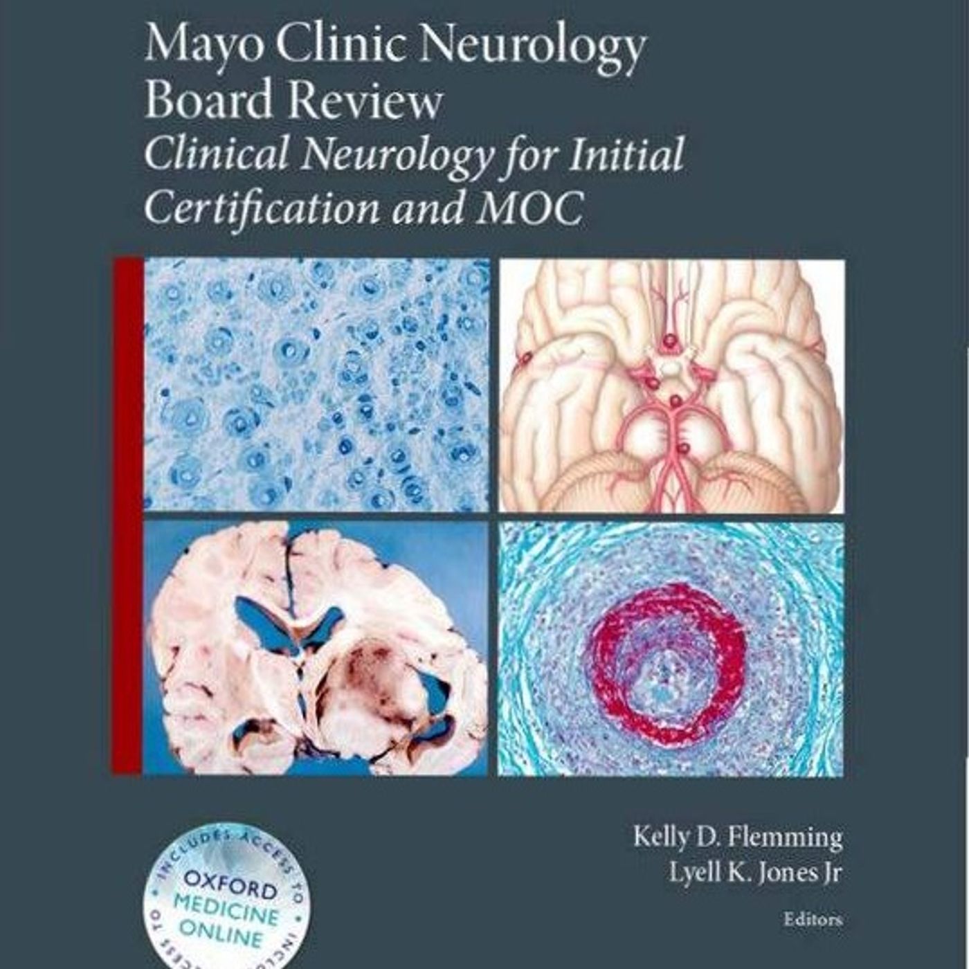 Mayo Clinic Neurology Board Review: Clinical Neurology for Initial Certification and MOC episode artwork