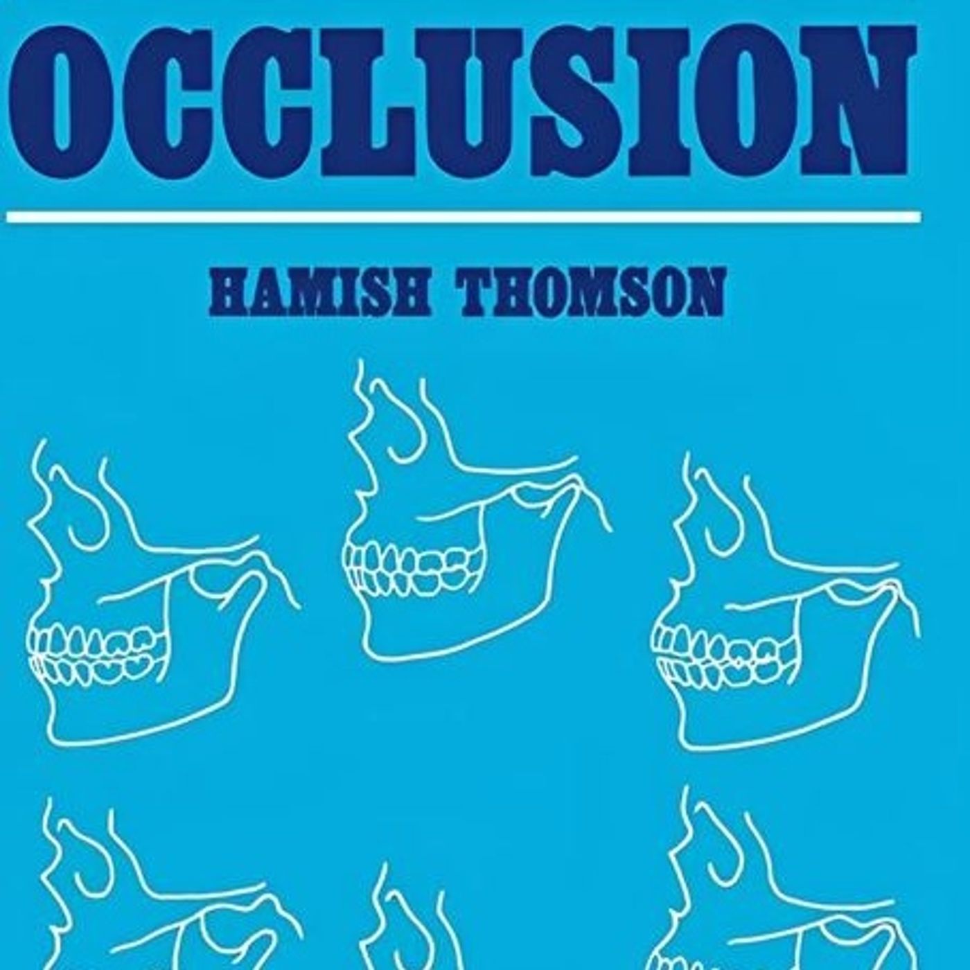 Occlusion