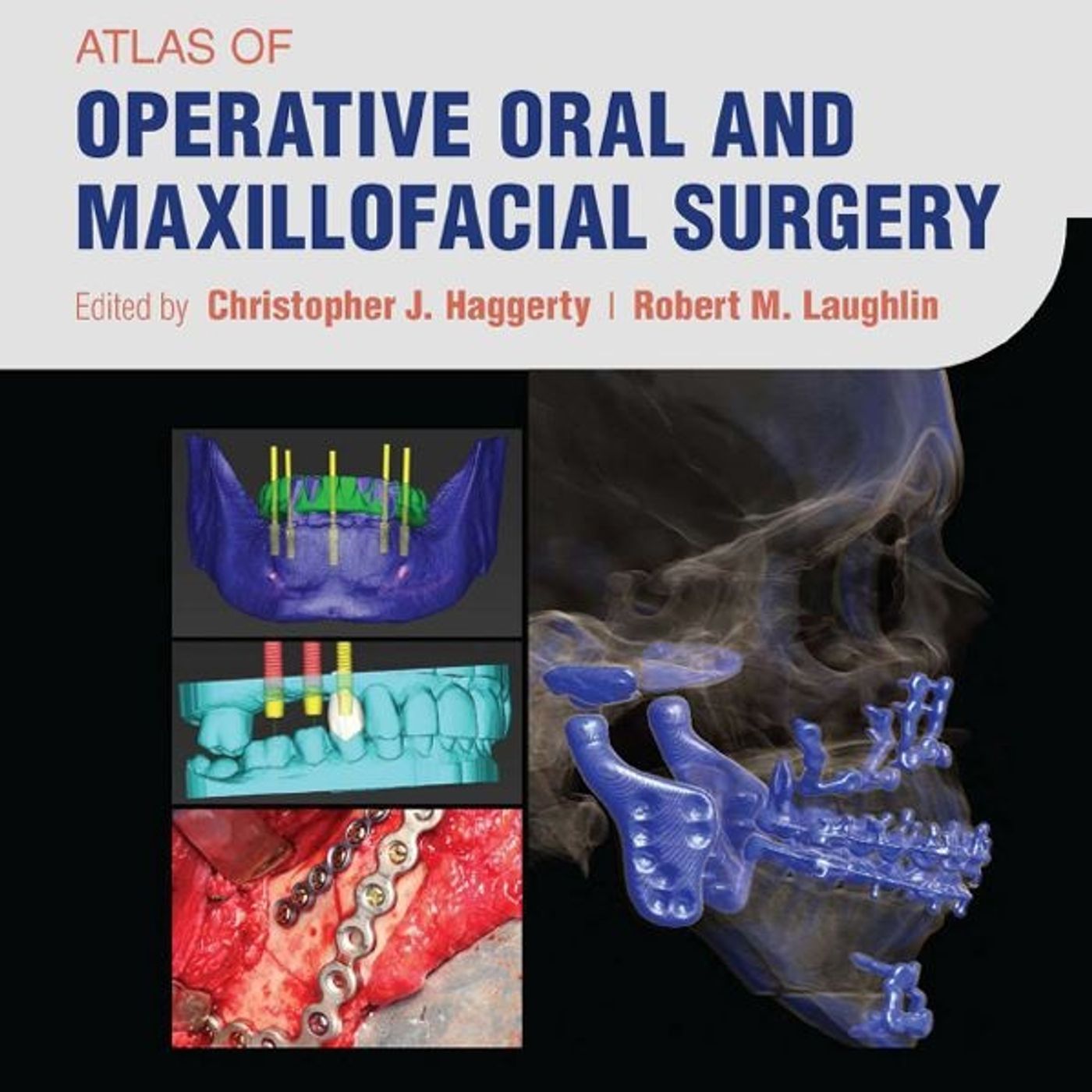 Atlas of Operative Oral and Maxillofacial Surgery