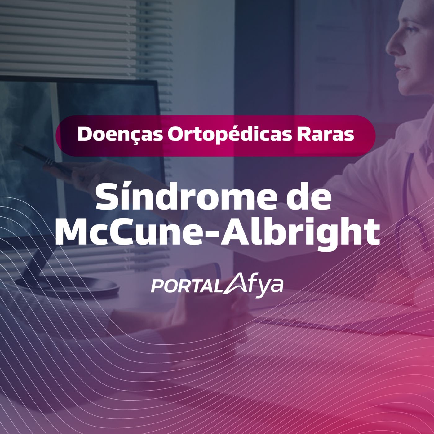 Podcast #154: Série Doenças Ortopédicas Raras: Síndrome de McCune-Albright episode artwork
