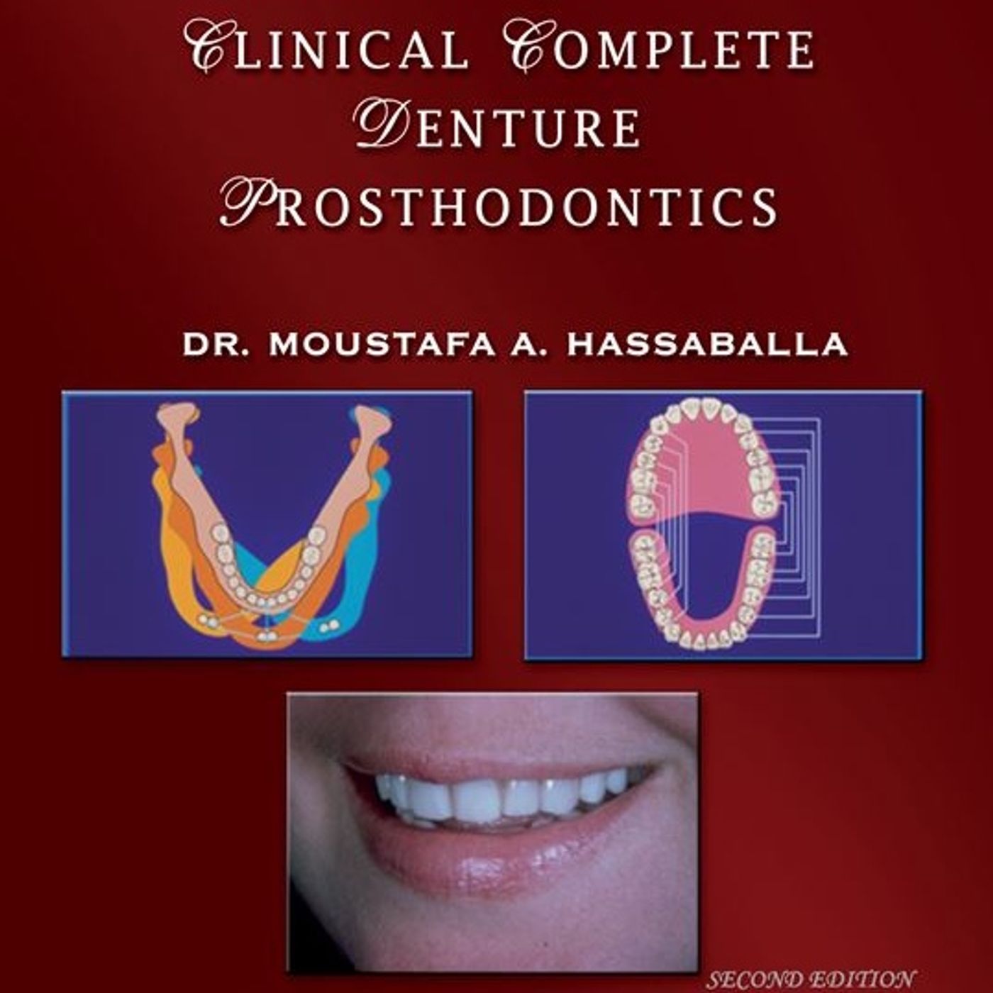 Clinical Complete Denture Prosthodontics