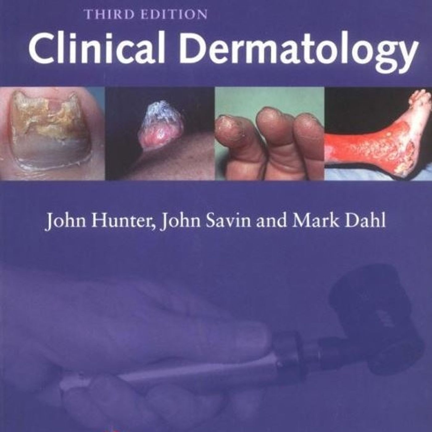 Clinical Dermatology