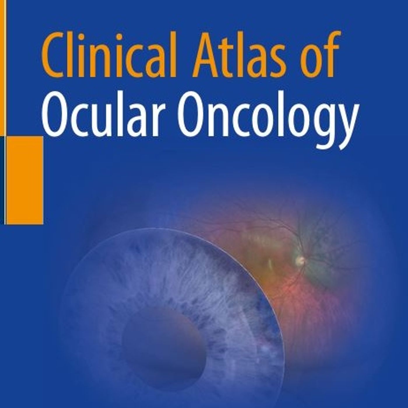 Clinical Atlas of Ocular Oncology