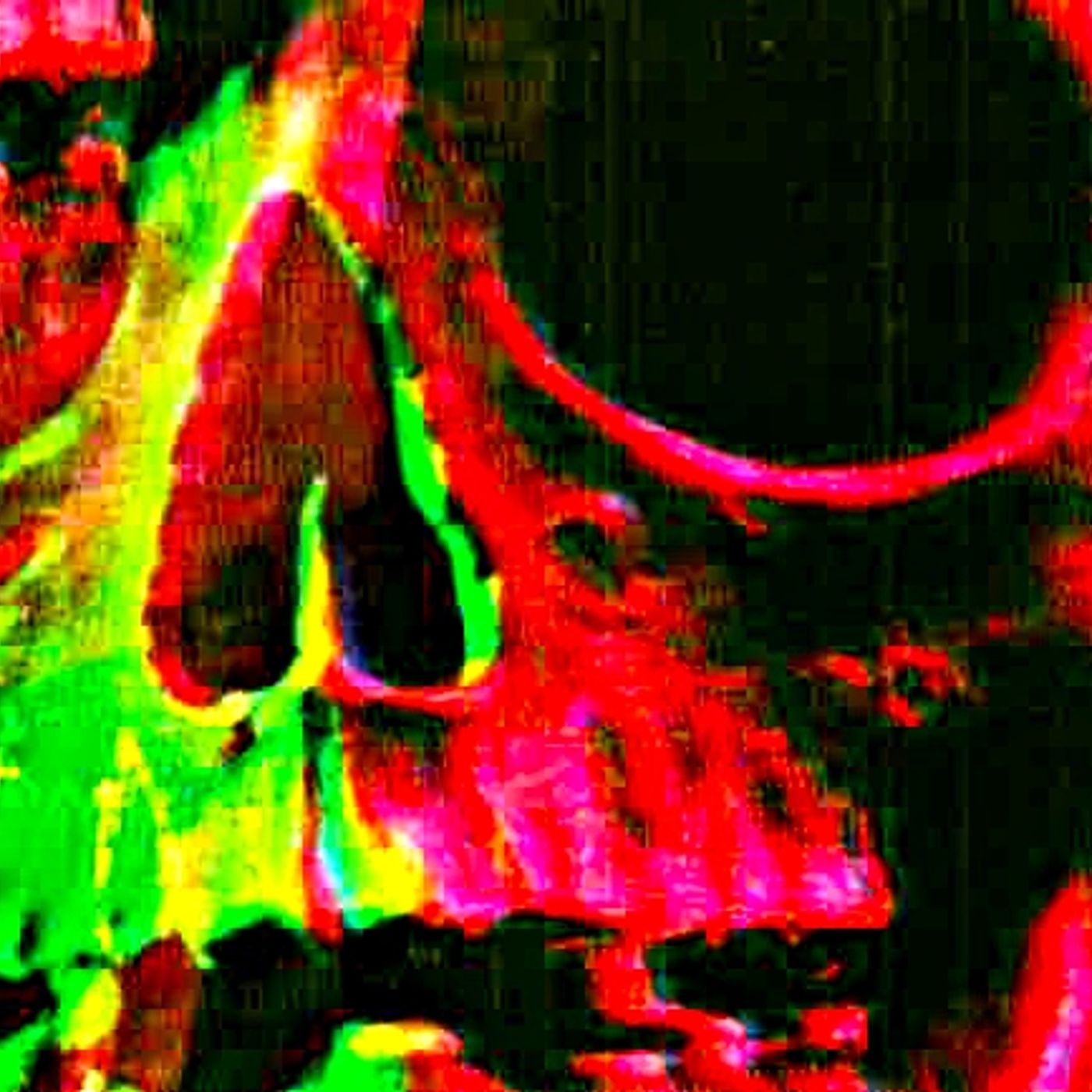 Yiyo SsL Enemigos