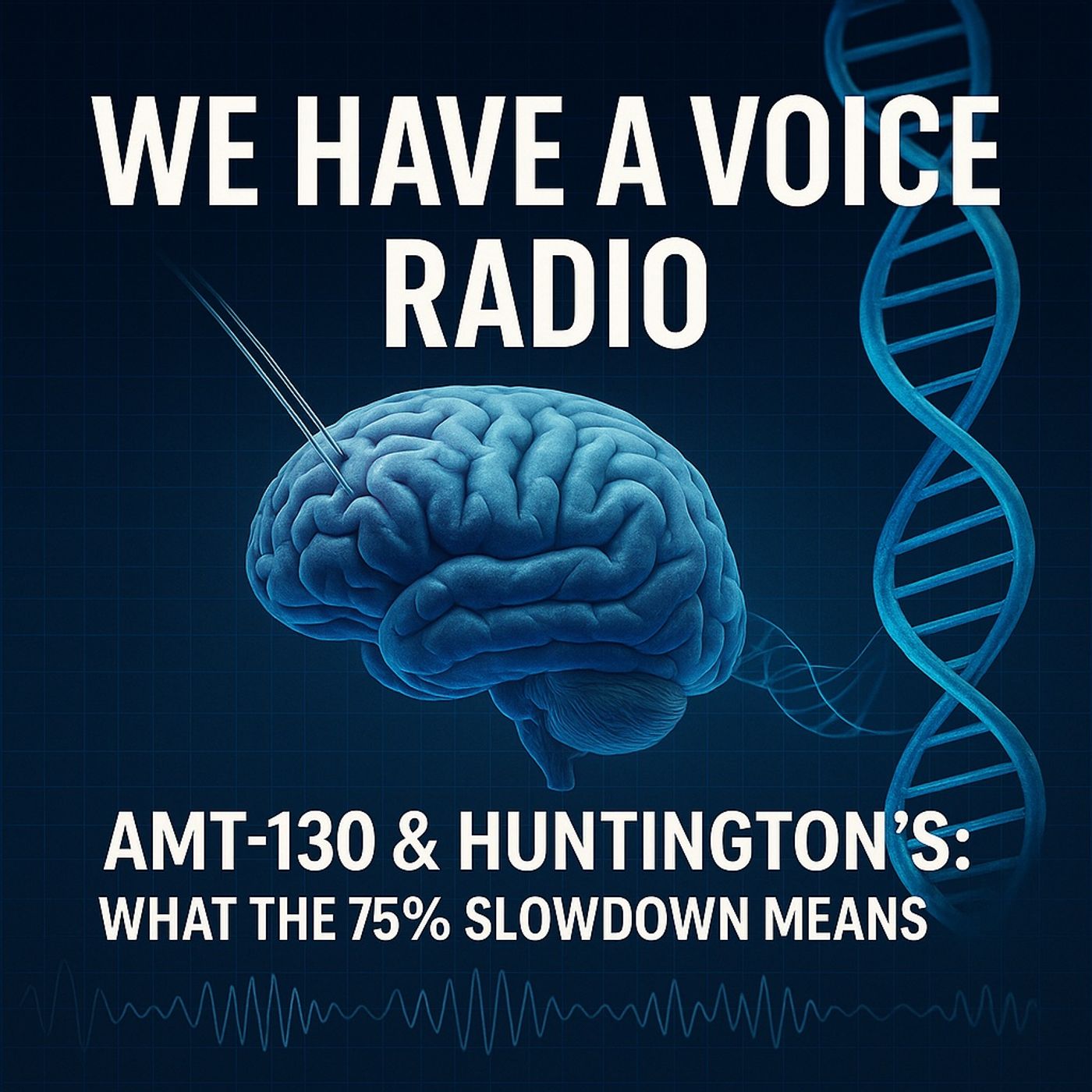 AMT-130 and the 75% Slowdown: What Just Changed for Huntington’s Disease—and What Hasn’t