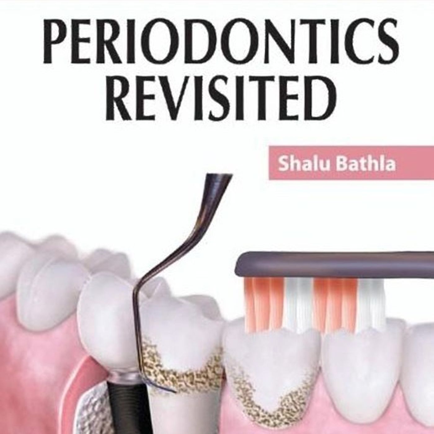 Periodontics Revisited