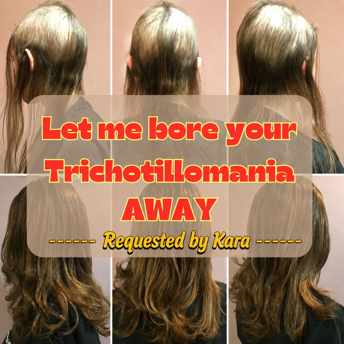 (request for Kara) (Short Music) Let me bore your Trichotillomania (hair pulling) AWAY episode artwork