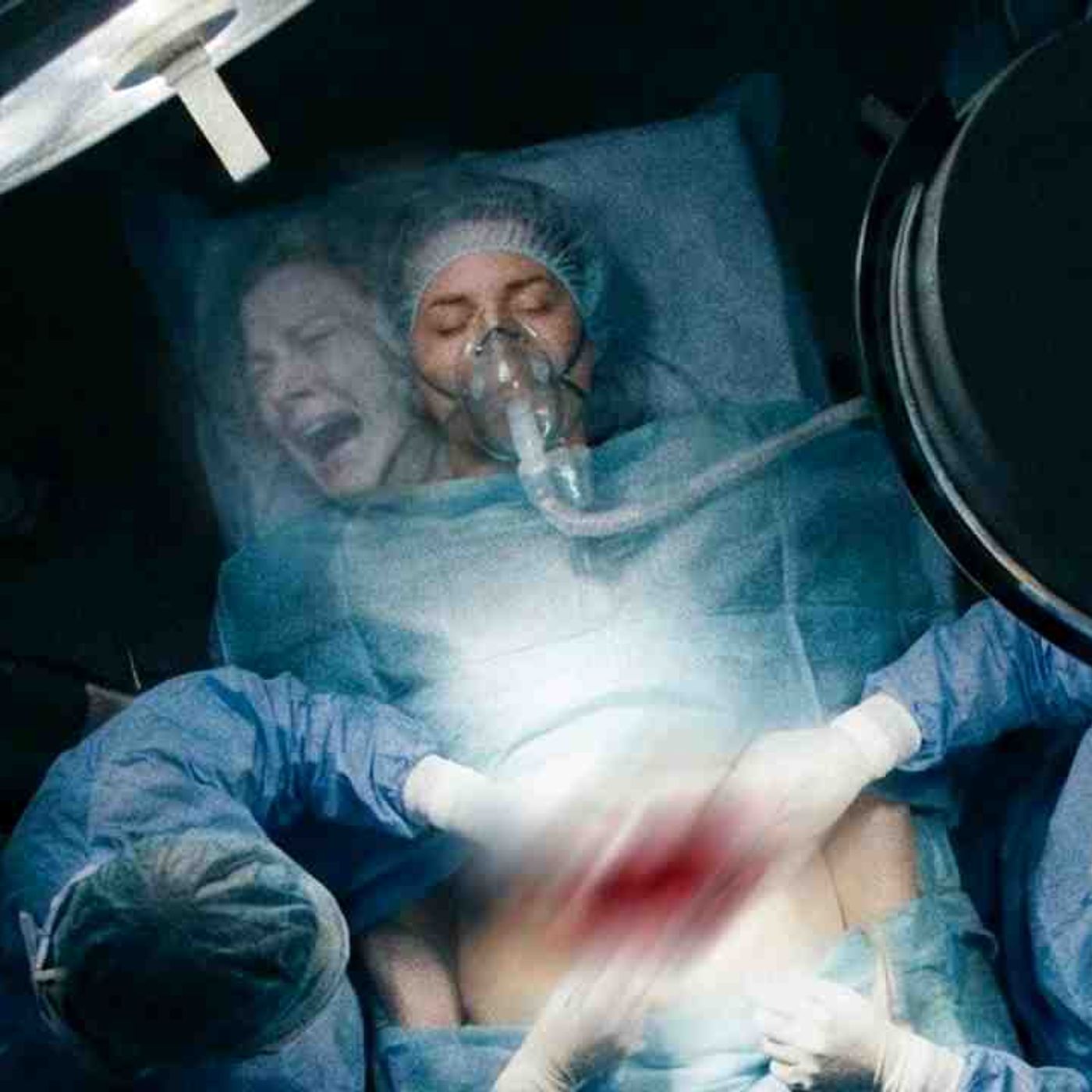 The Worst Surgical Nightmares(MP3_160K) episode artwork