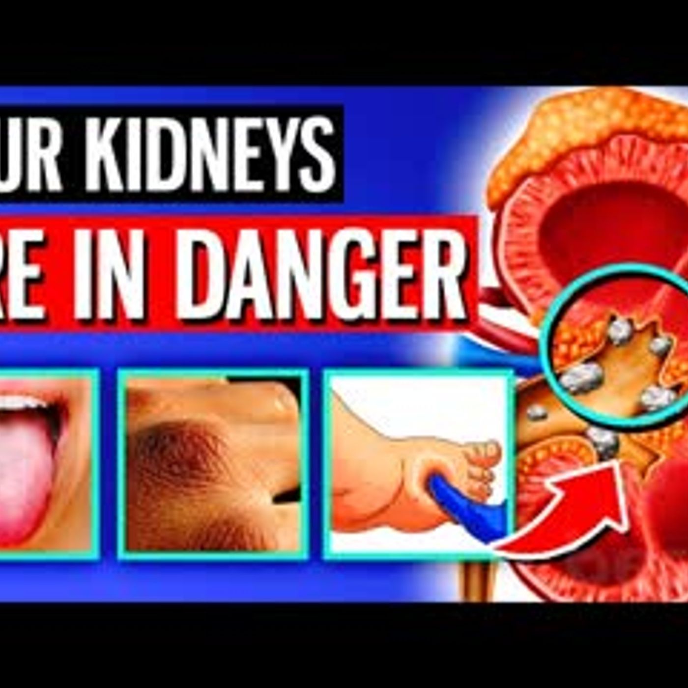 11 ALARMING Signs Your Kidneys Are Crying For Help episode artwork