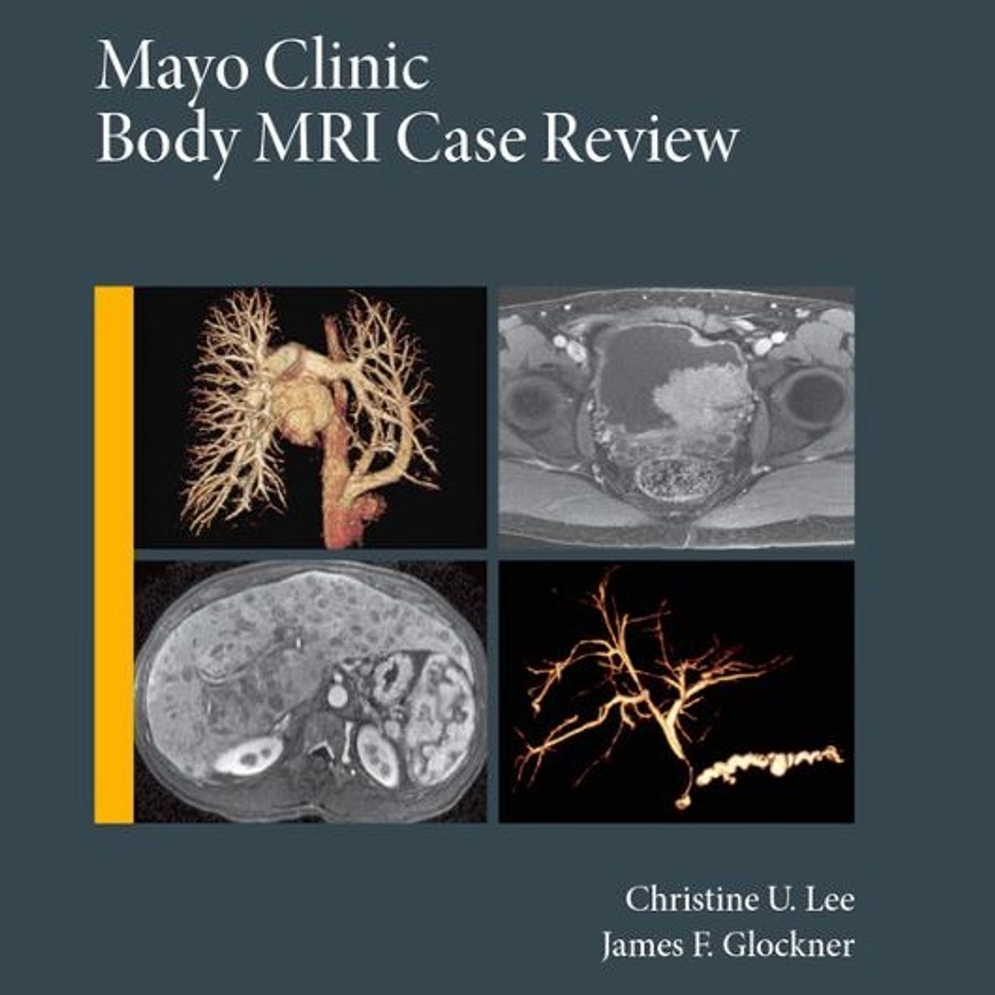 Mayo Clinic Body Mri: Case Review
