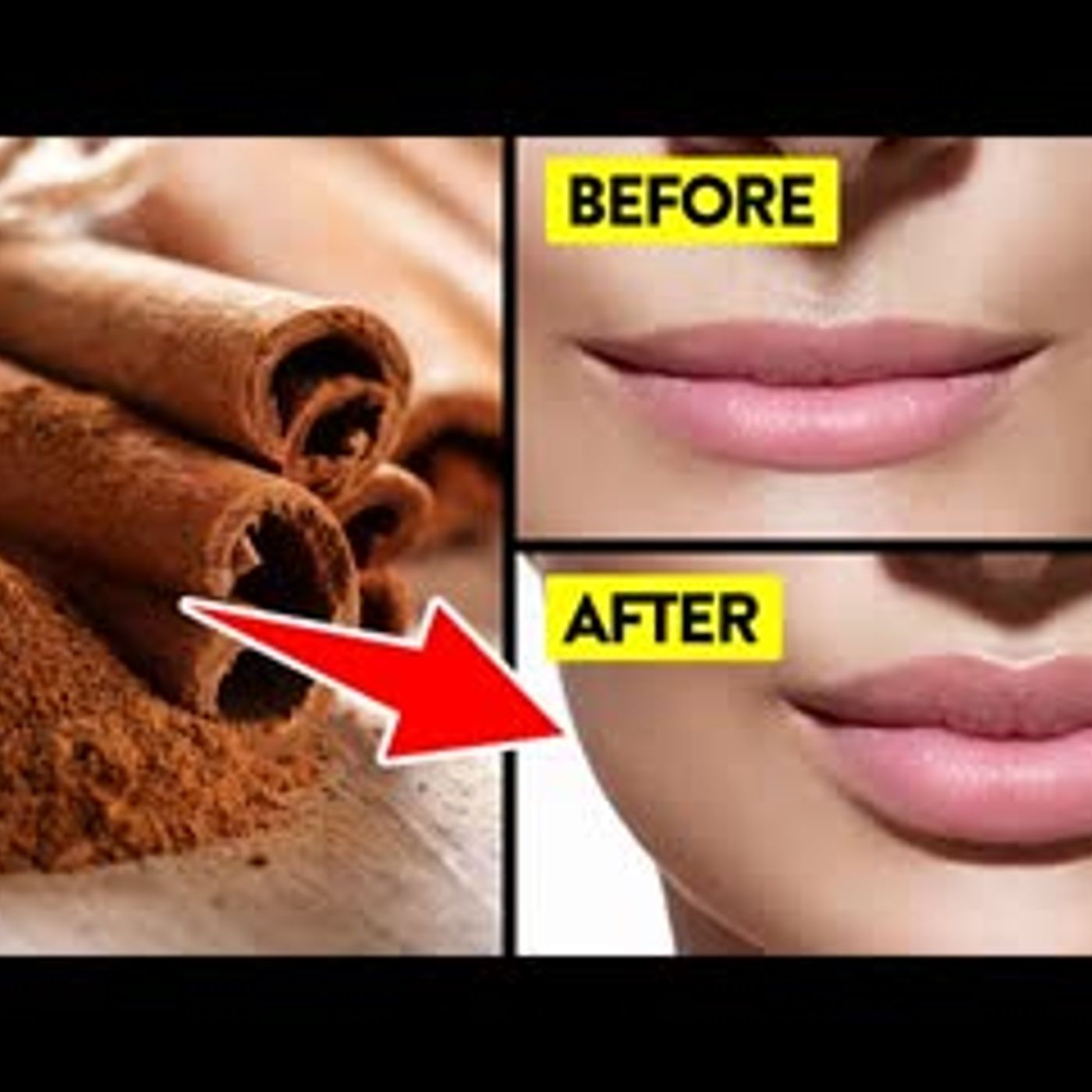 14 POWERFUL Science Backed Health Benefits Of Cinnamon DAILY episode artwork
