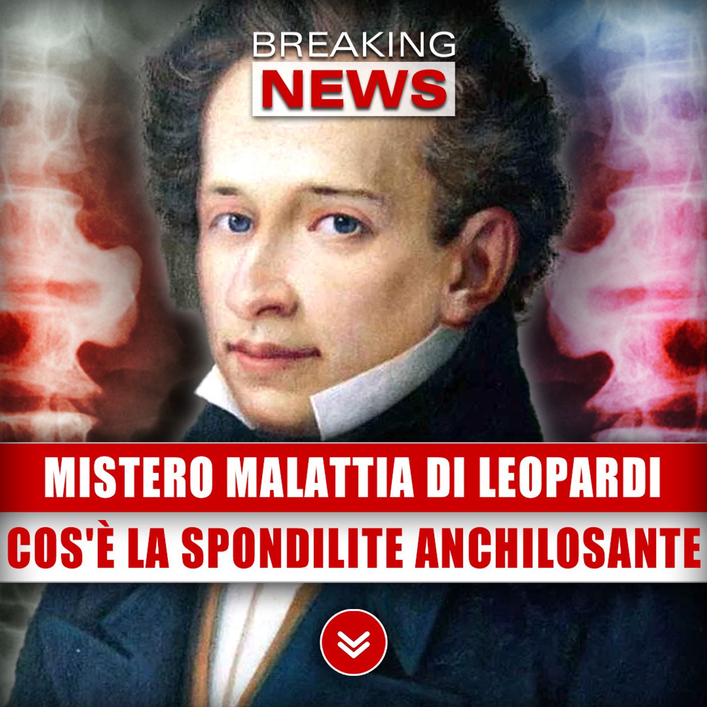 Mistero Sulla Malattia Di Giacomo Leopardi: Cos'è La Spondilite Anchilosante Giovanile!