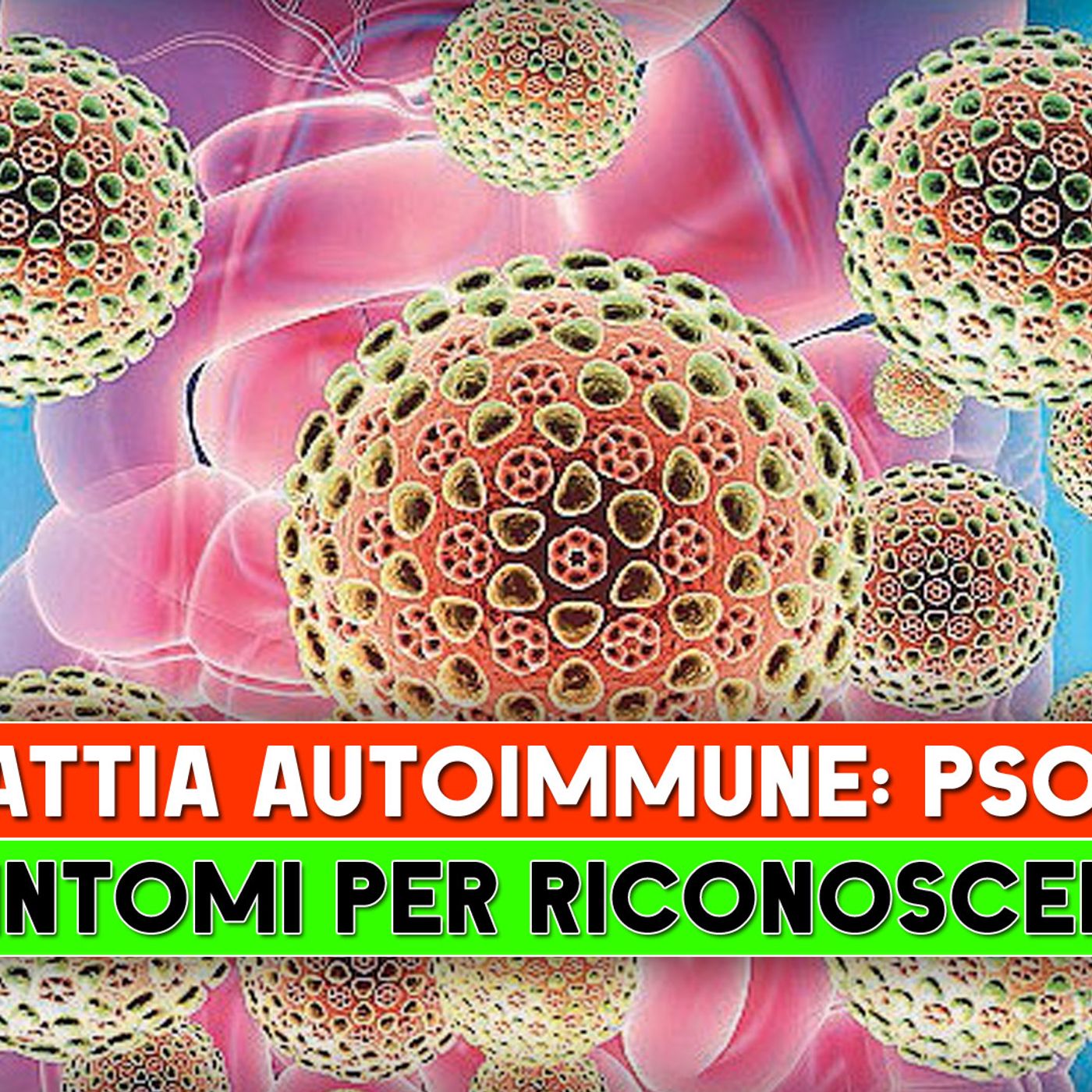 Malattia Autoimmune, Psoriasi: 5 Sintomi Per Riconoscerla! episode artwork