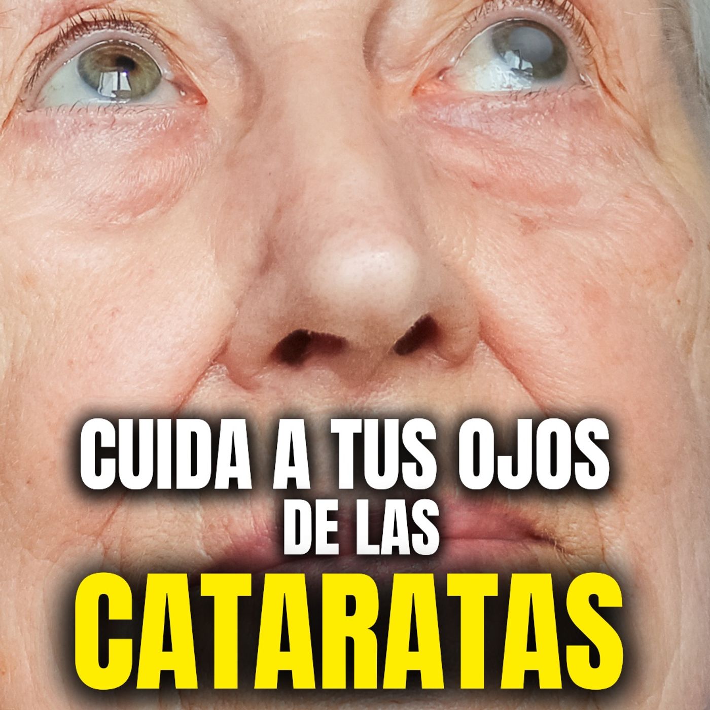 ¡No dejes que las cataratas nublen tu visión! 👀👓💡