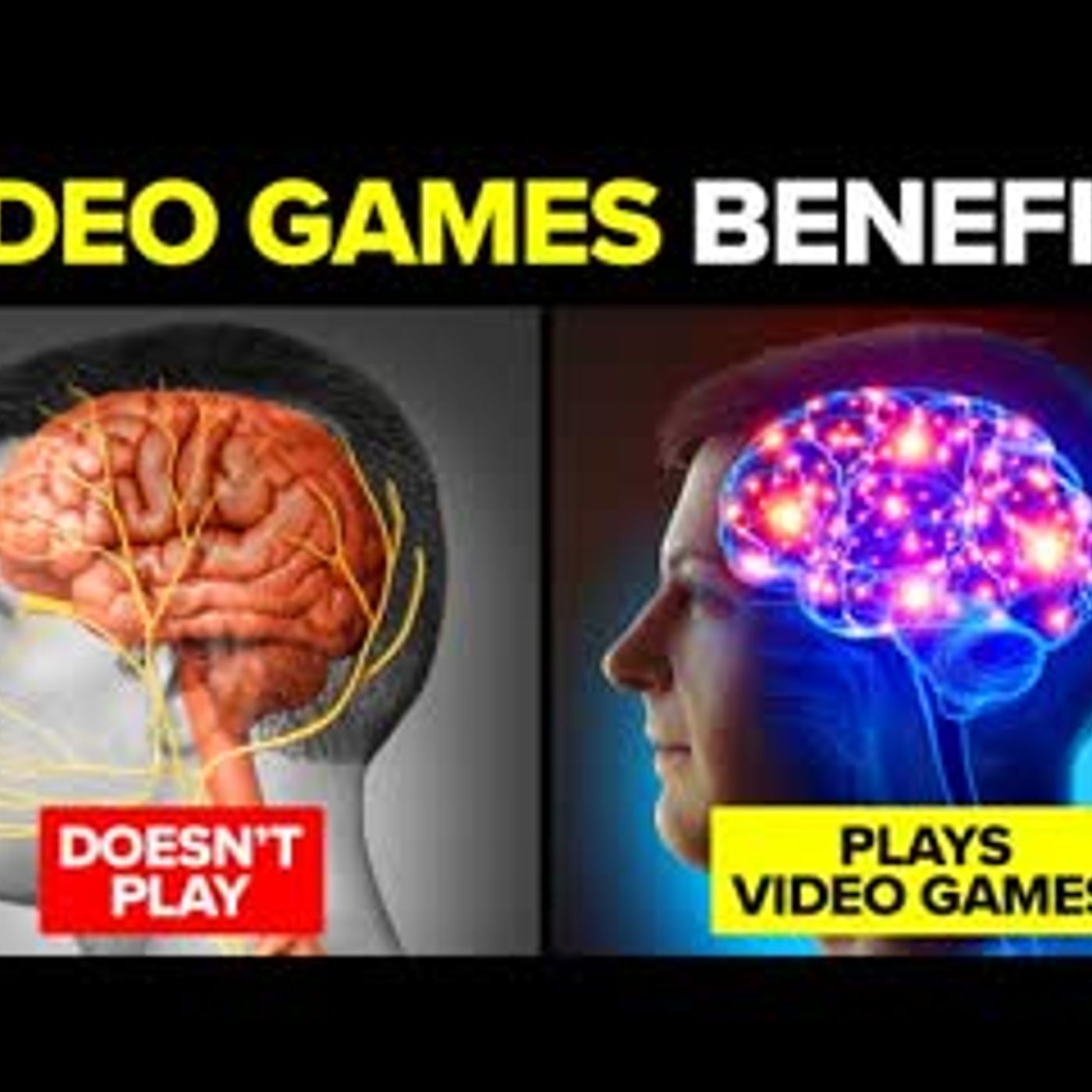 10 Secret Reasons Why Playing Video Games Is Good For Your Brain episode artwork