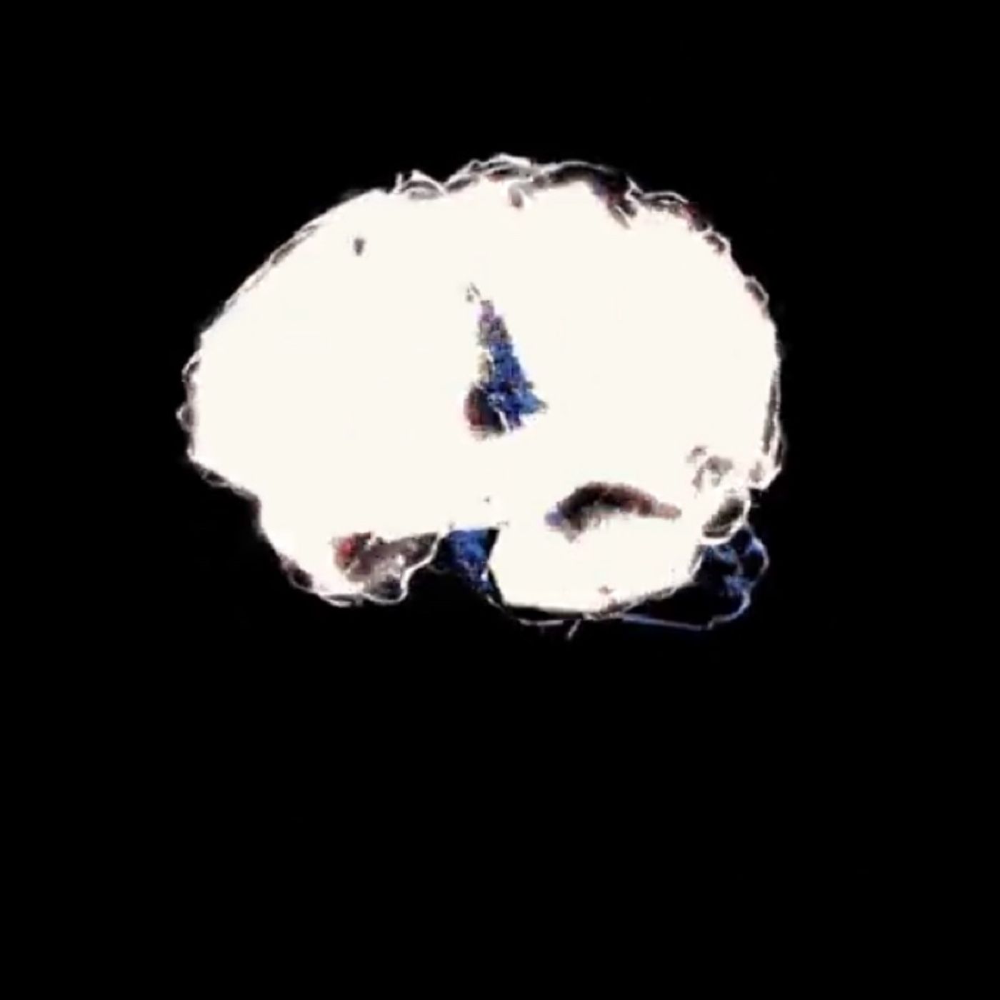 Food for thought- Book Burning episode artwork