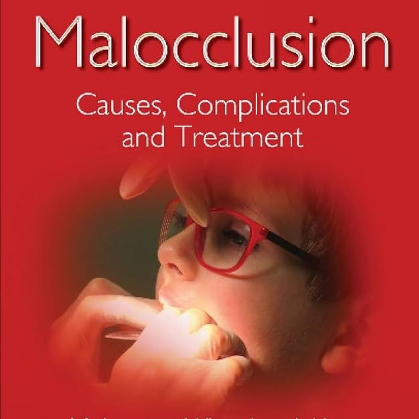 Malocclusion: Causes, Complications and Treatment (Dentistry and Oral Sciences) Malocclusion: Causes, Complications and Treatment (Dentistry and Oral Sciences)