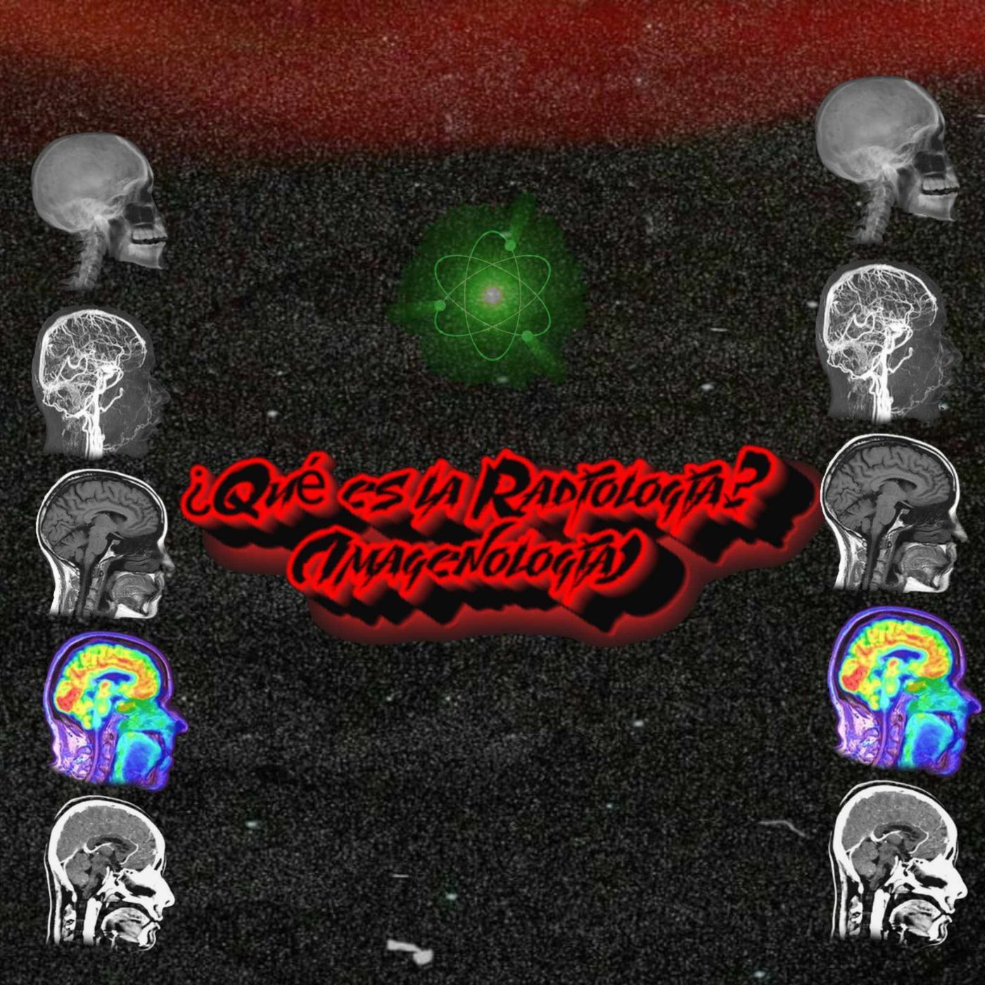 ¿Qué es la radiología (imagenología)? episode artwork