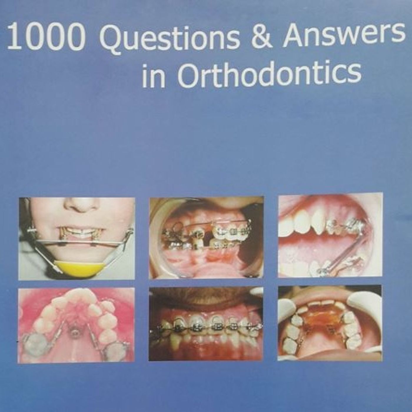 1000 Questions & Answers in Orthodontics