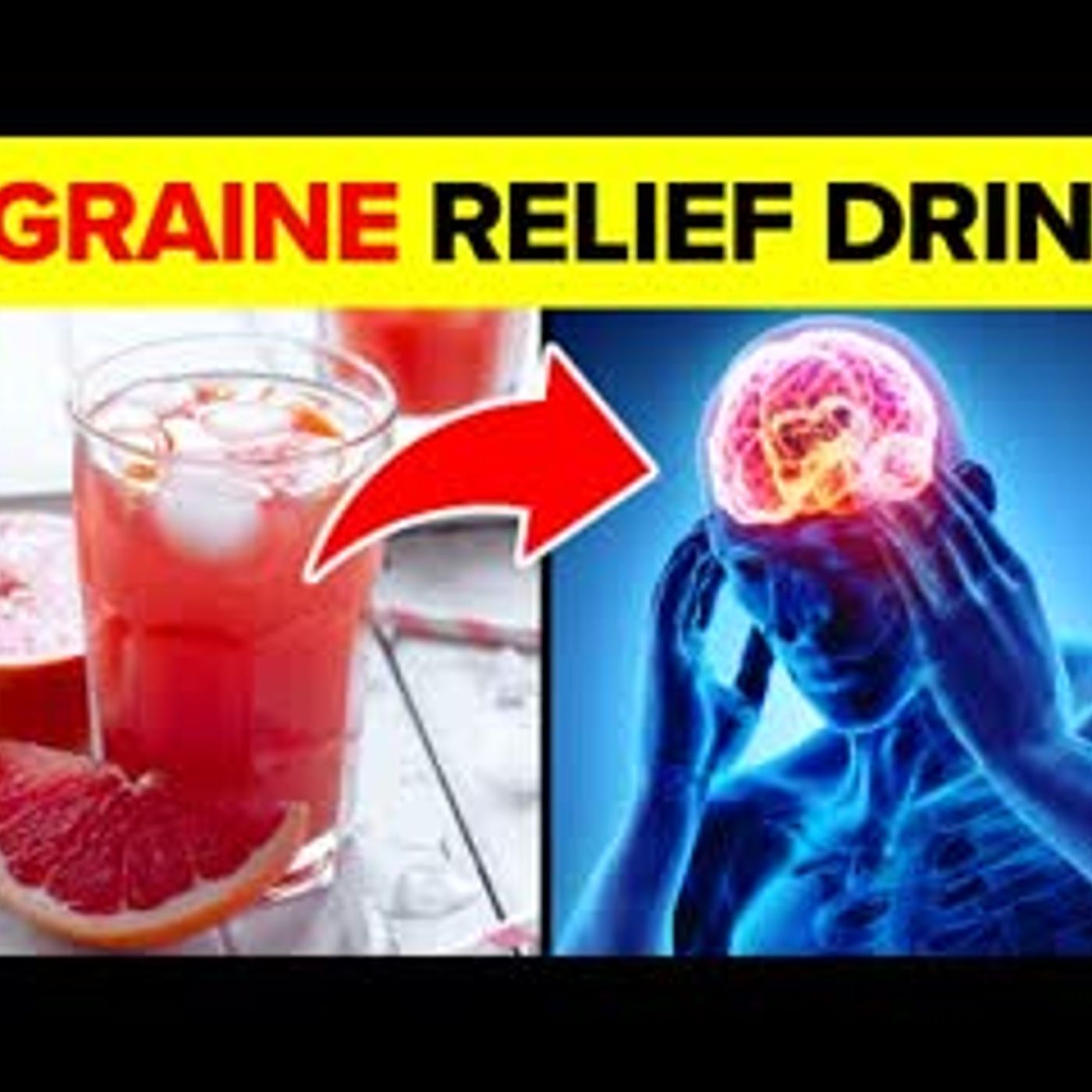 12 Drinks That Will Relieve Your Migraine episode artwork