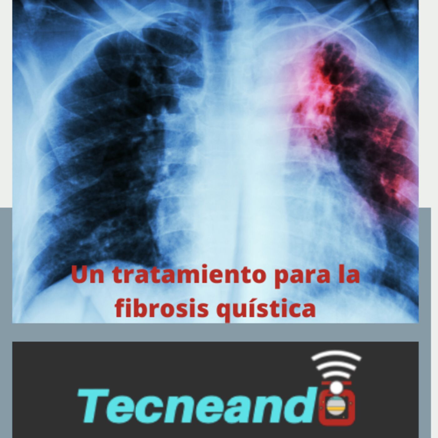 Tecneando