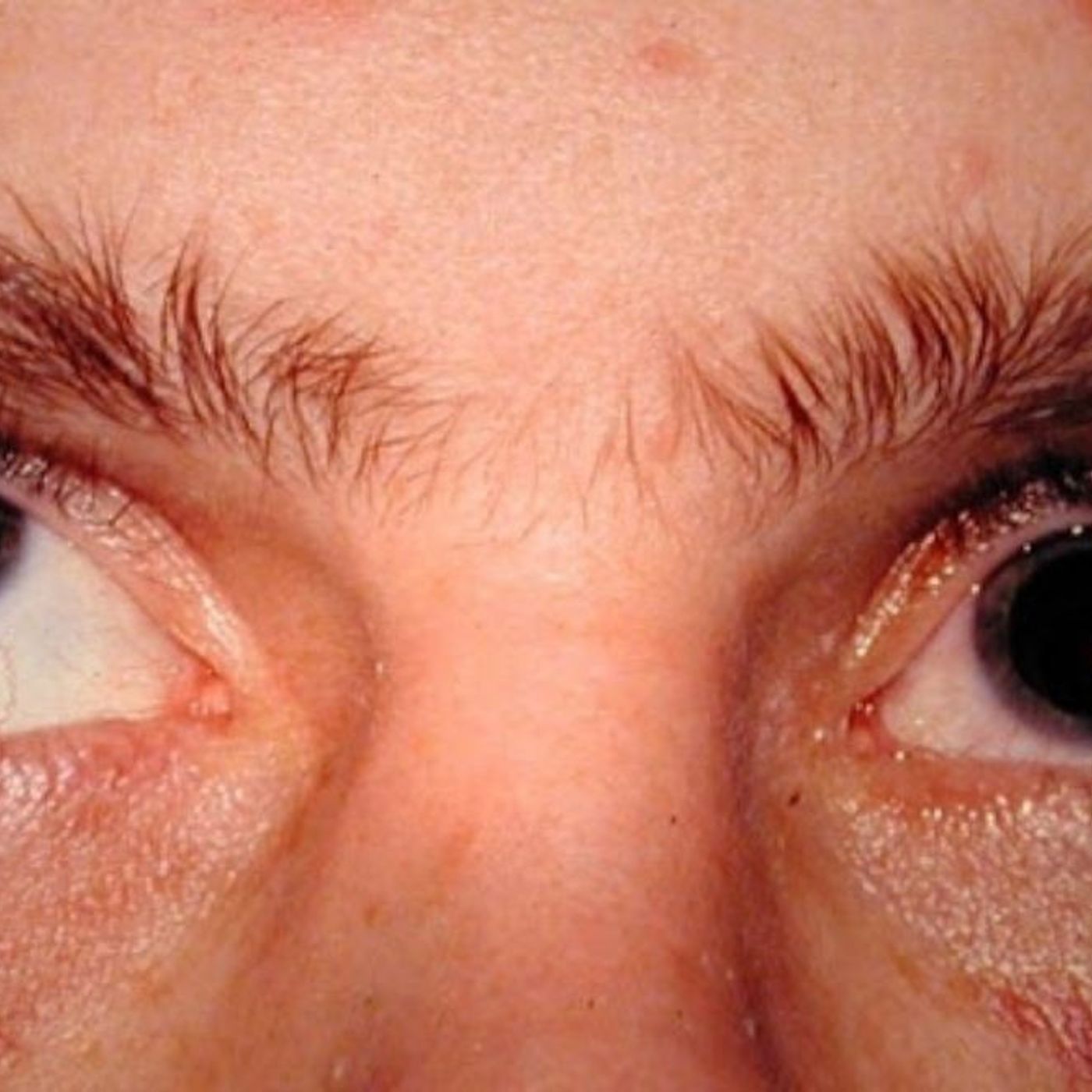 The Eye News