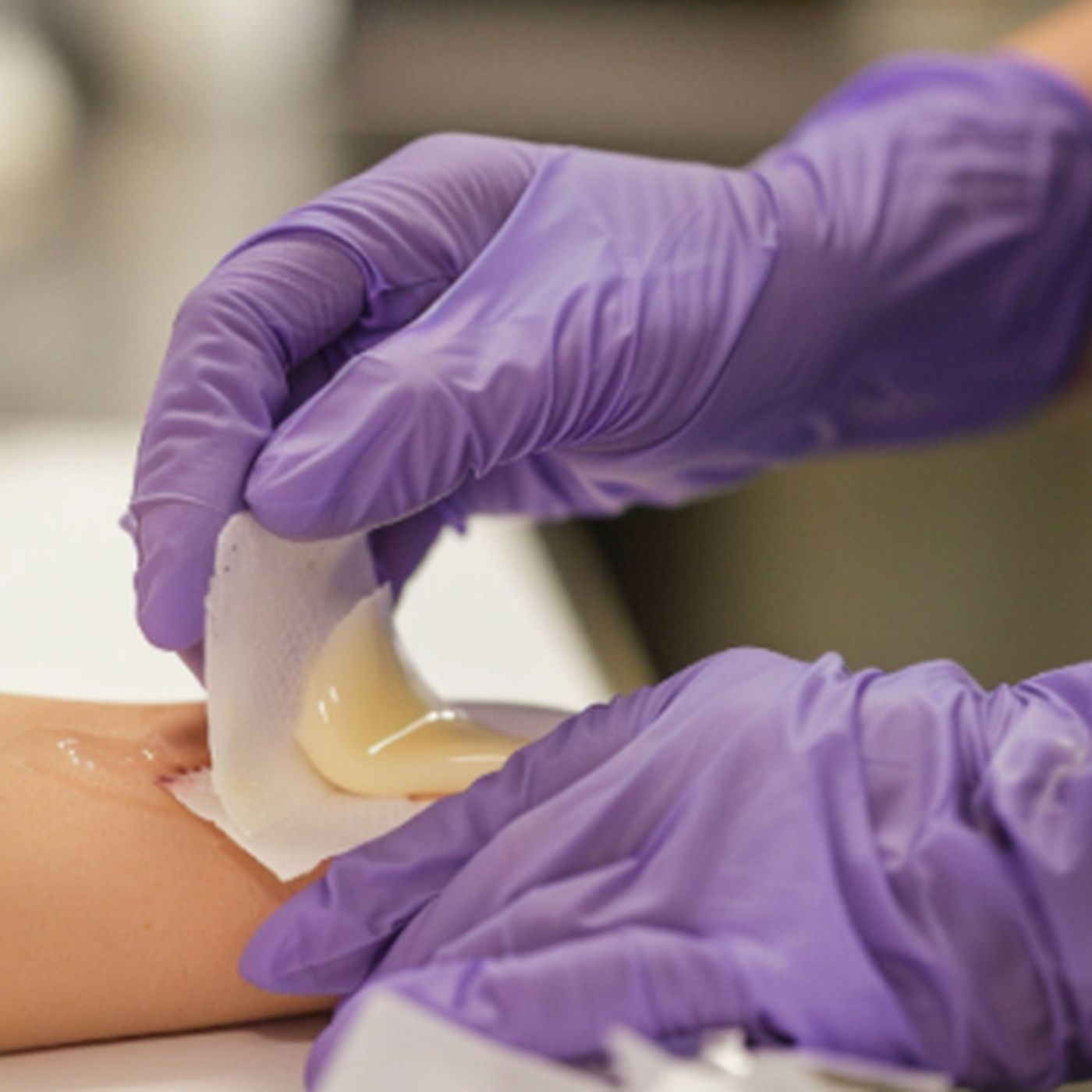 The Wound Pros Audio Blog
