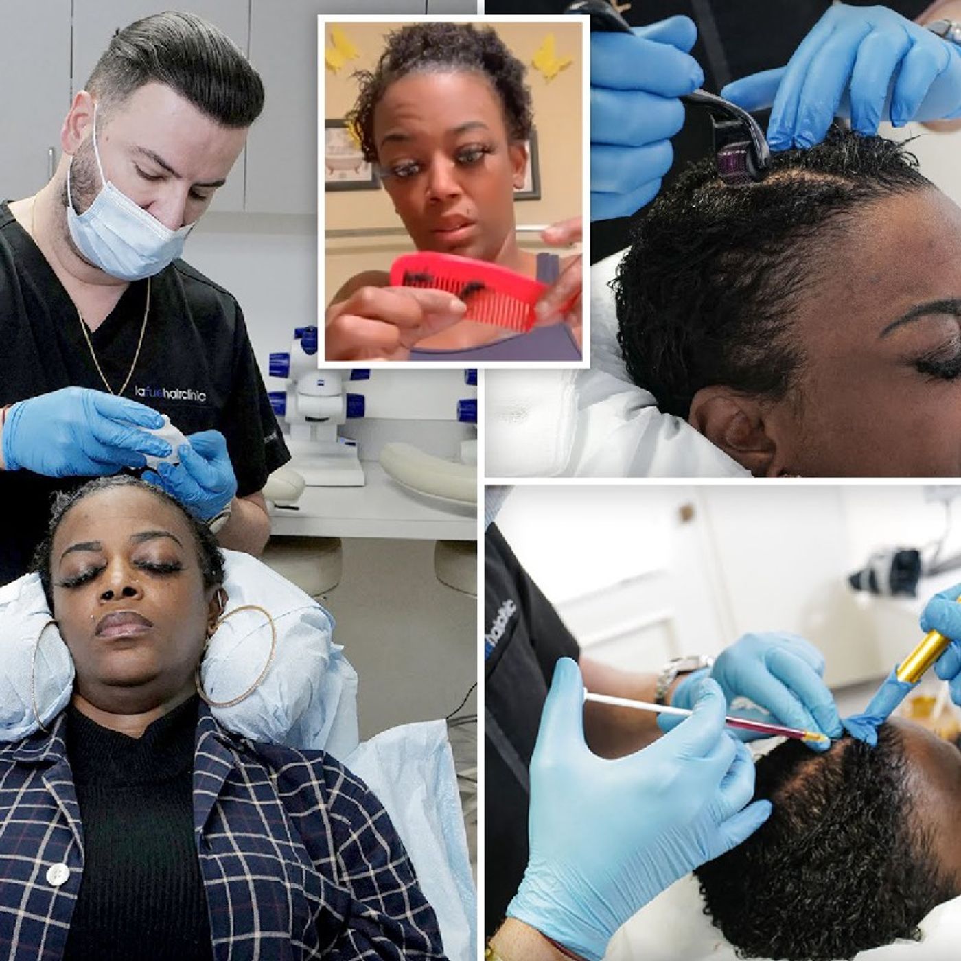 'Gorilla Glue Girl' Receives Stem Cell & Plasma Treatment After Hair Dye Fiasco episode artwork