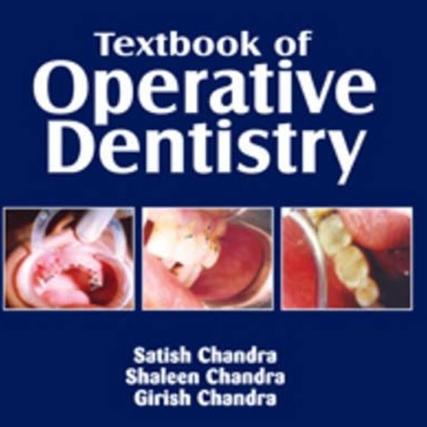 Textbook of Operative Dentistry (with MCQs)