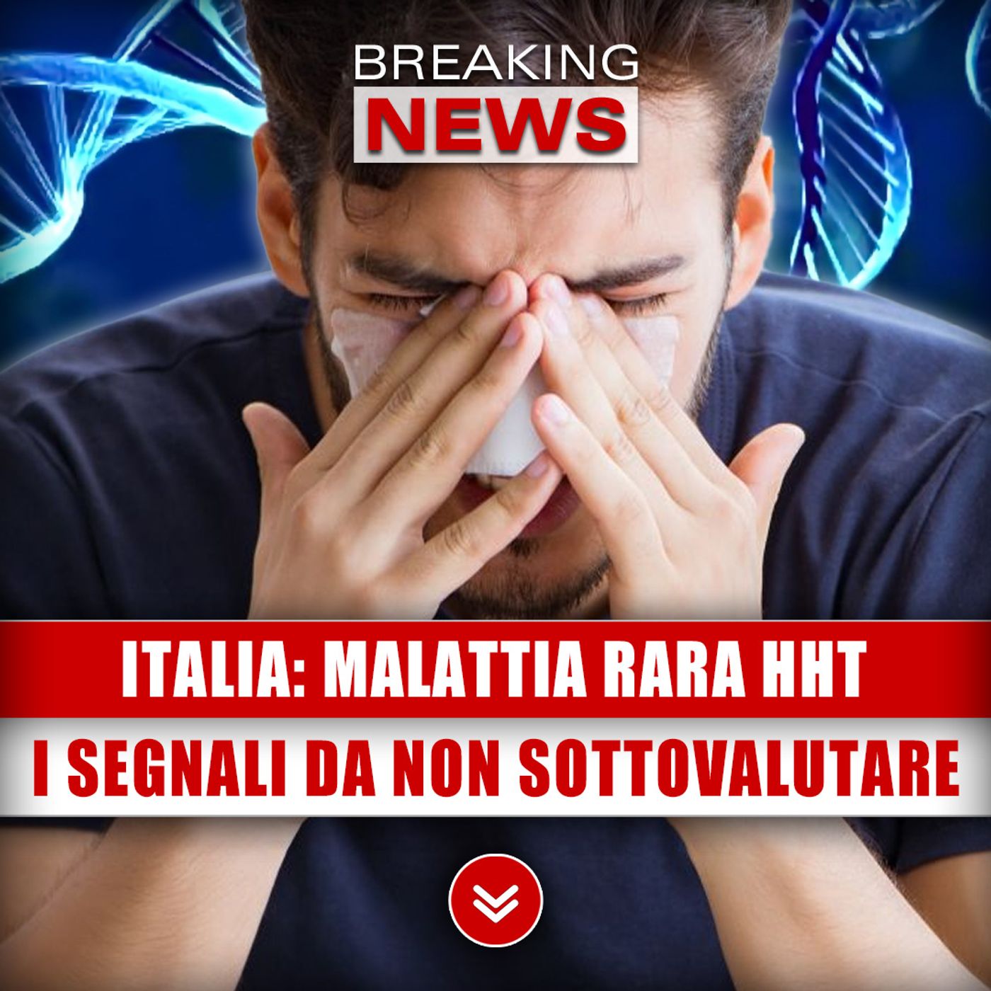 Italia, Malattia Rara HHT: I Segnali Da Non Sottovalutare!