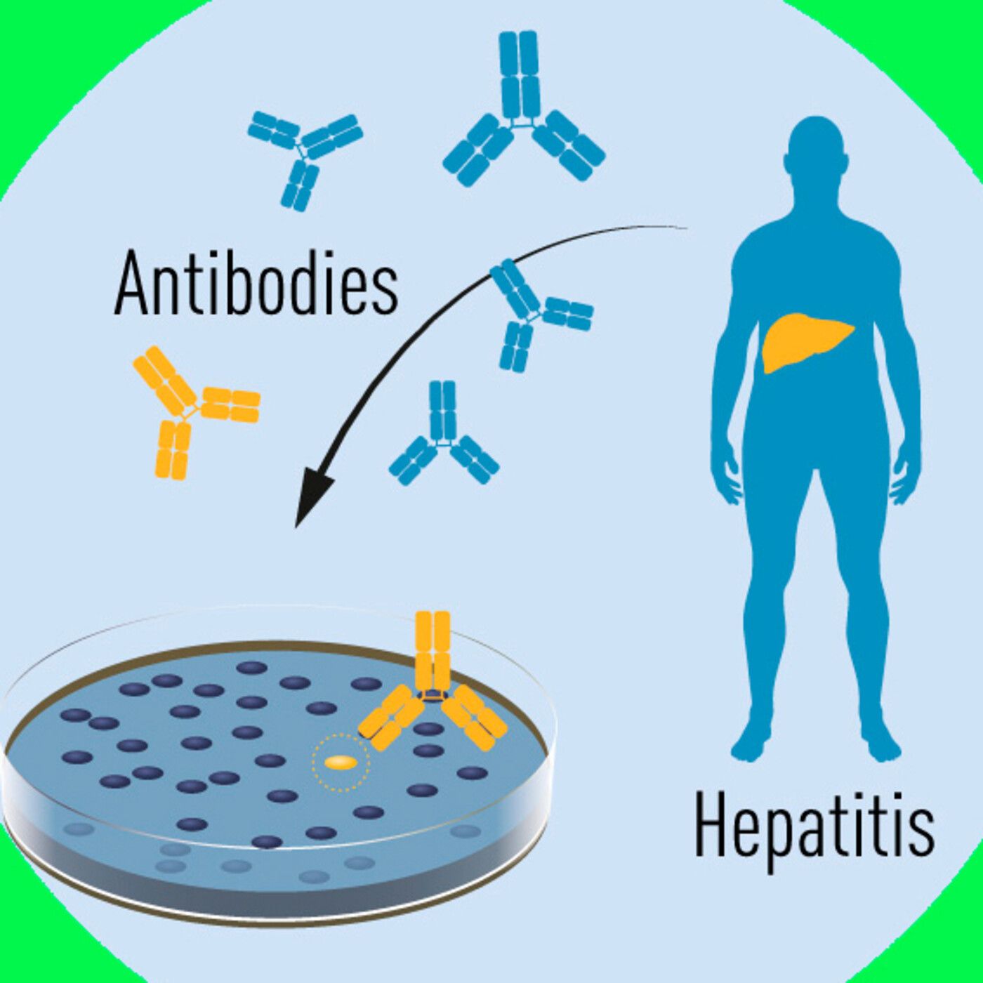 O que hai que escoitar