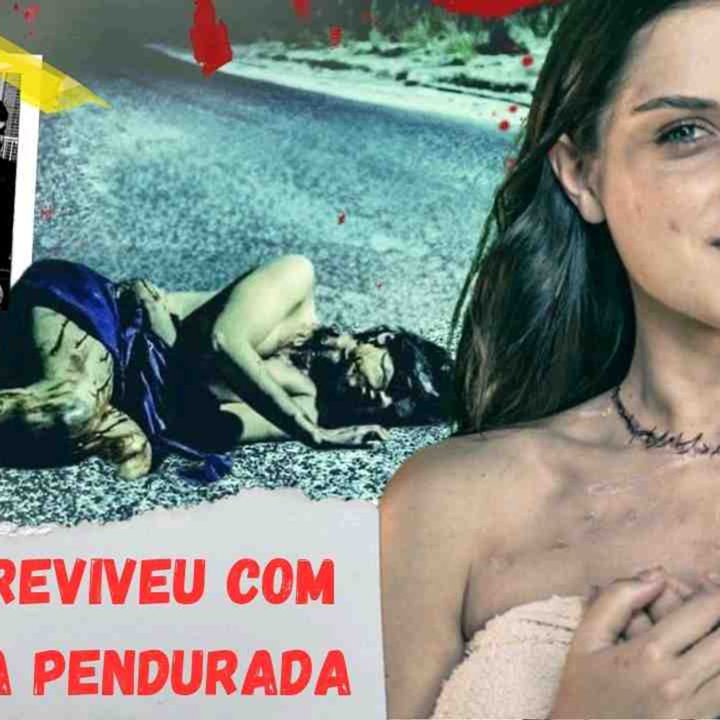 Alison Botha_ encontrada quase sem a cabeça_ com os órgã0s para fora do c_rpo... e viva