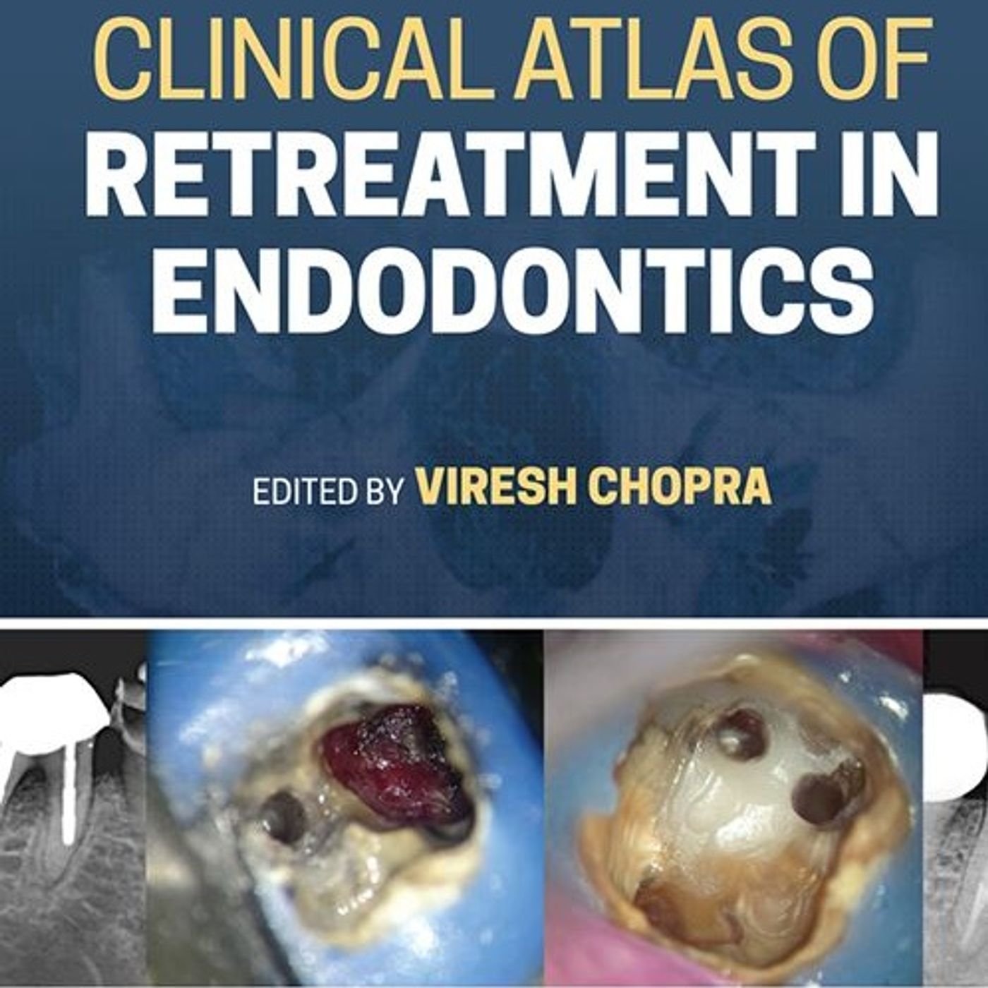 Clinical Atlas of Retreatment in Endodontics