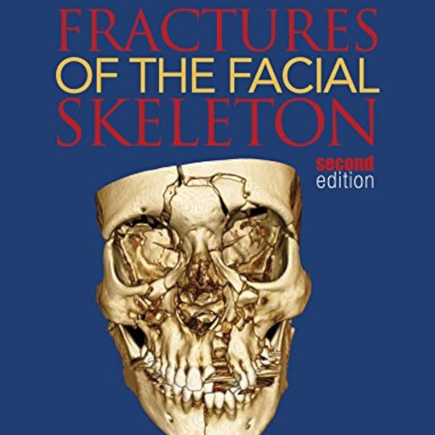Fractures of the Facial Skeleton