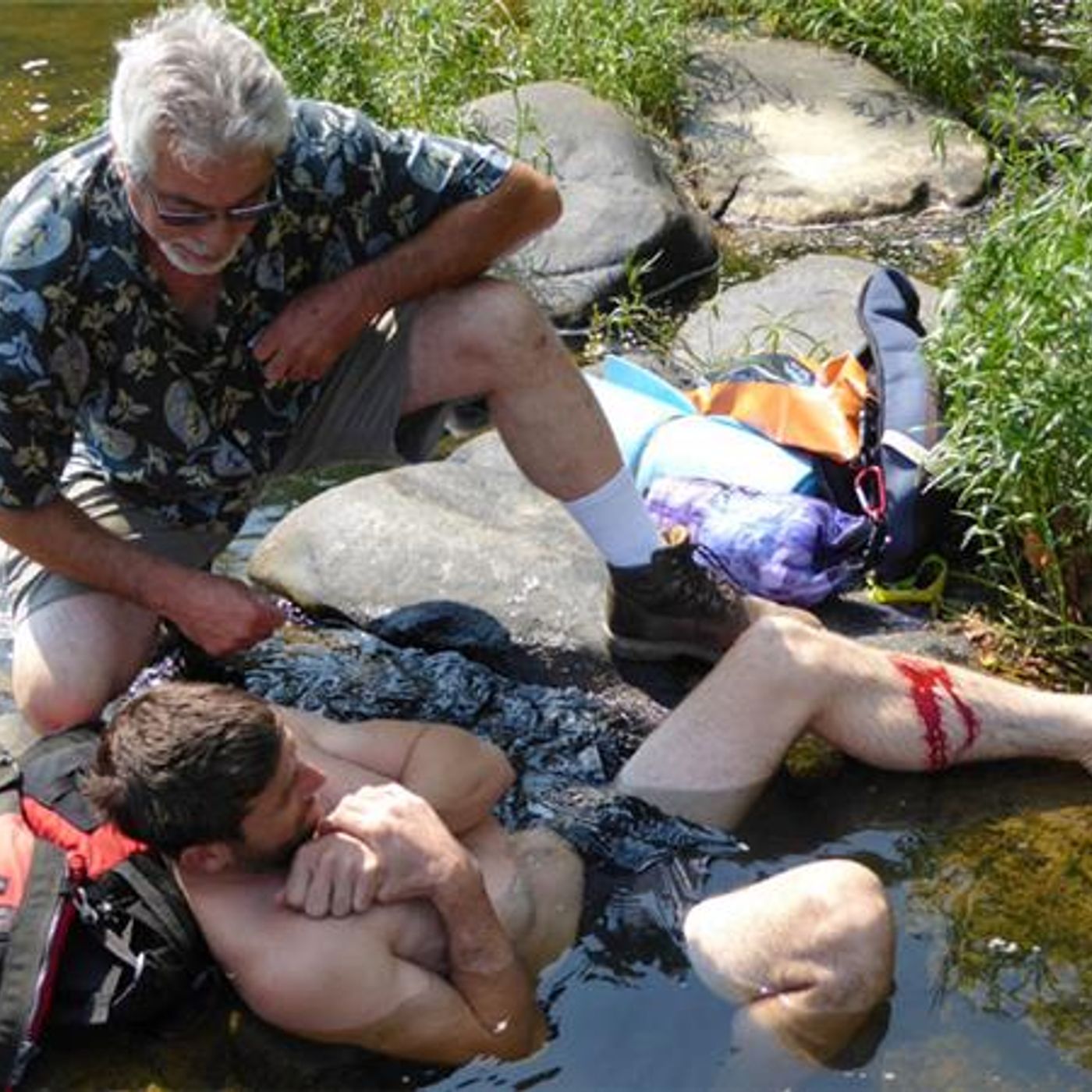 Surviving Sprains and Broken Bones when there is no help!