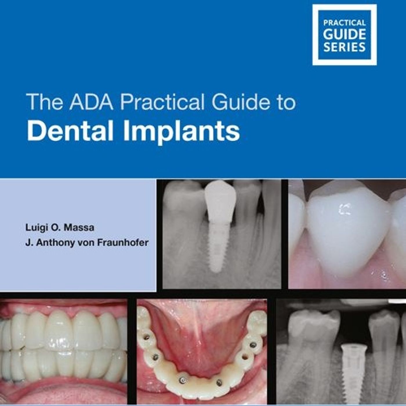 The ADA Practical Guide to Dental Implants