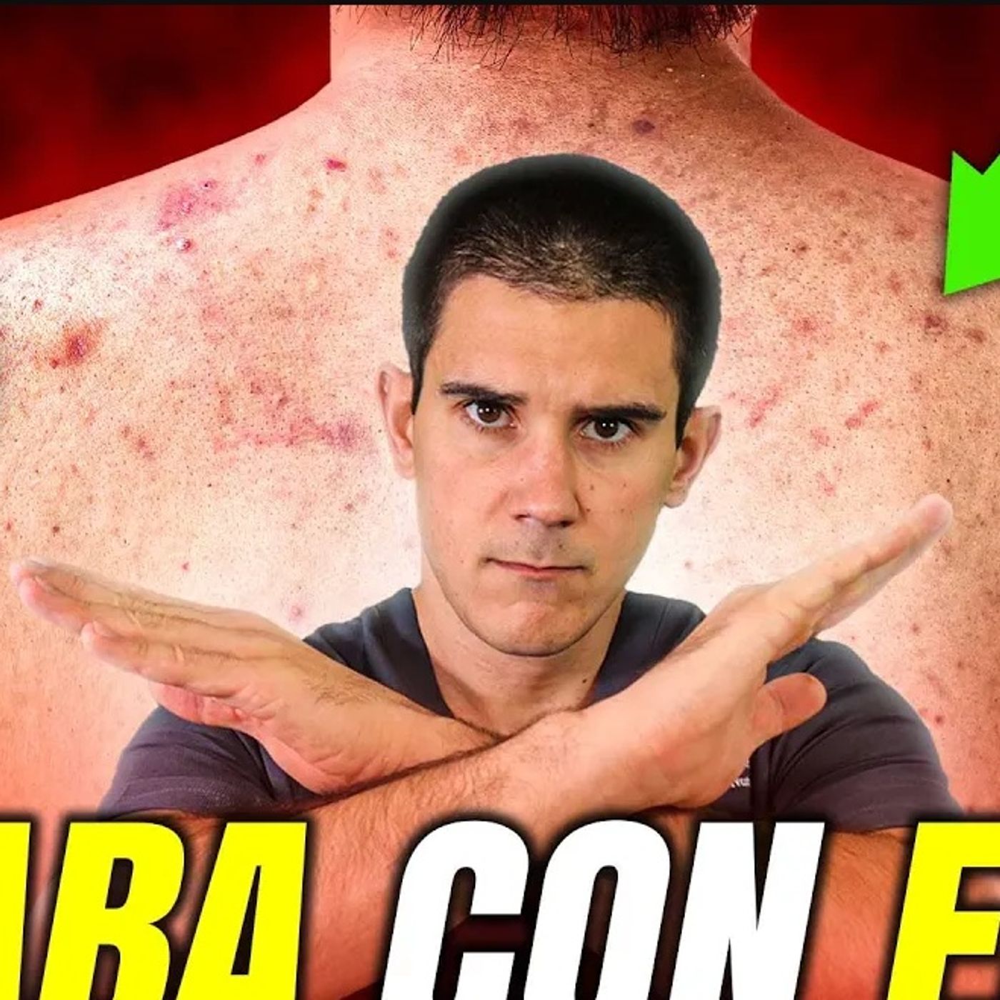 ¡ADIÓS ACNÉ!🧑‍⚕️Los SECRETOS MENOS CONTADOS para MEJORAR en POCOS DÍAS