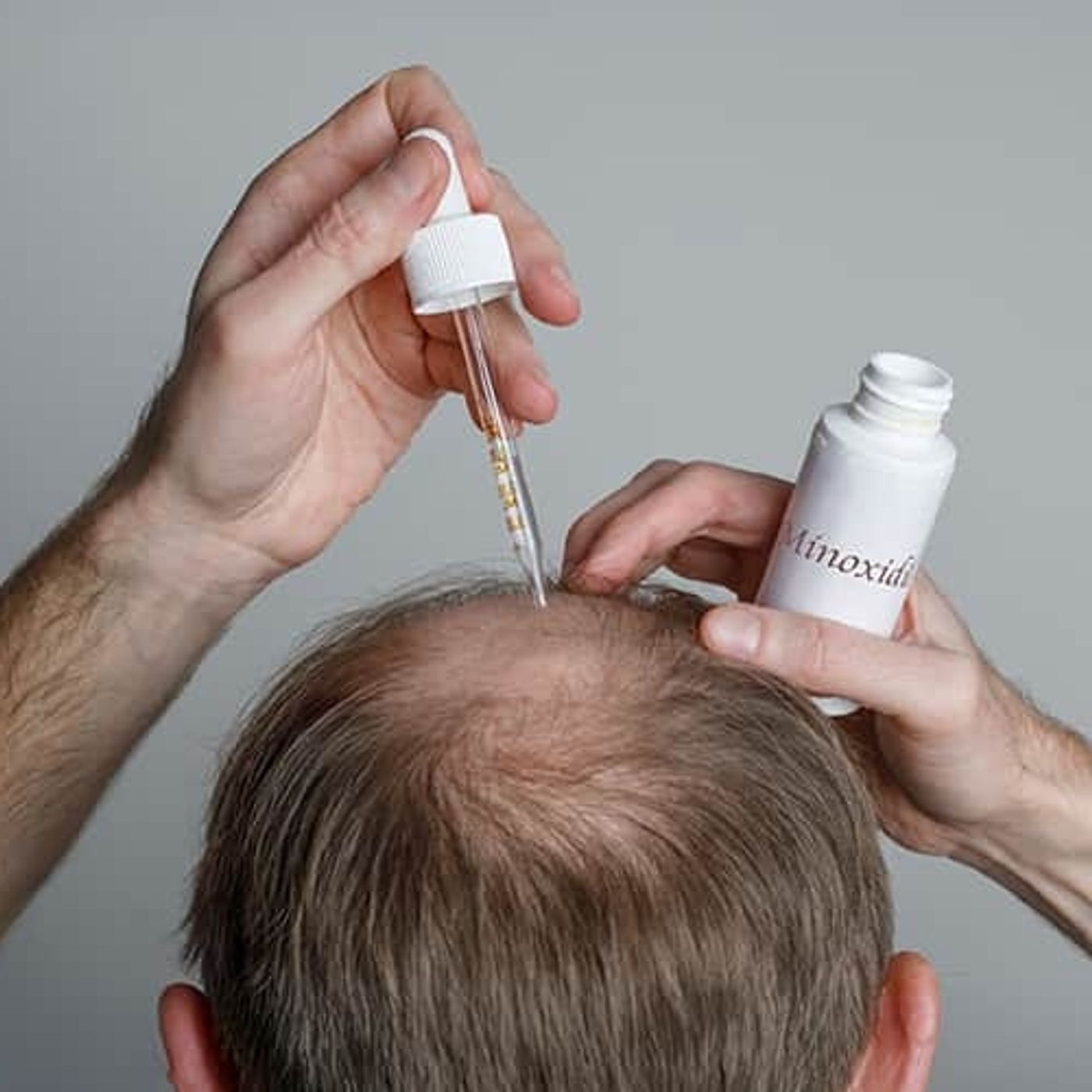 Minoxidil la soluzione topica contro la caduta dei capelli episode artwork